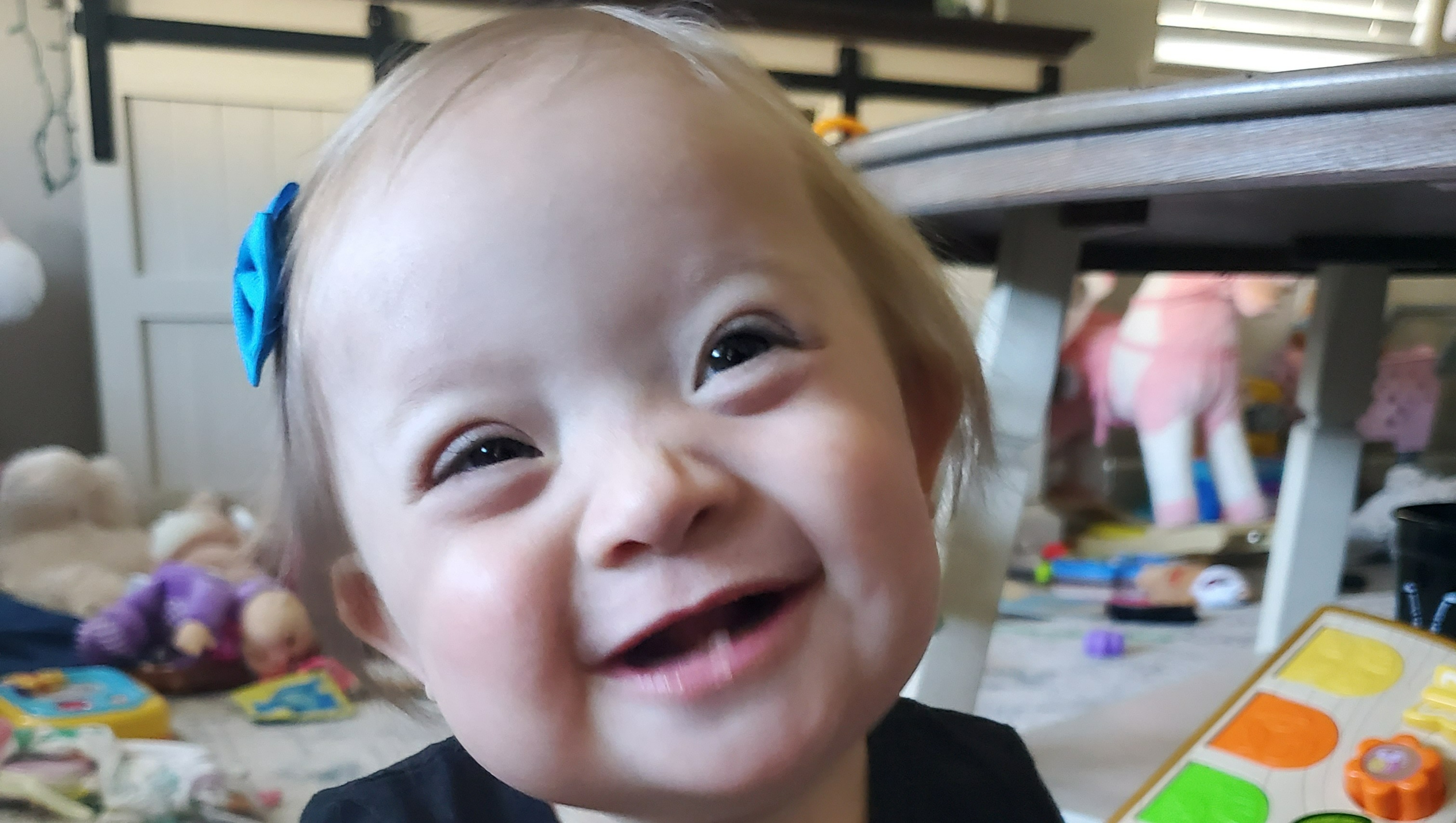 The Journey To Healthy Weight: Supporting Skinny Individuals With Down Syndrome - q8bslf9