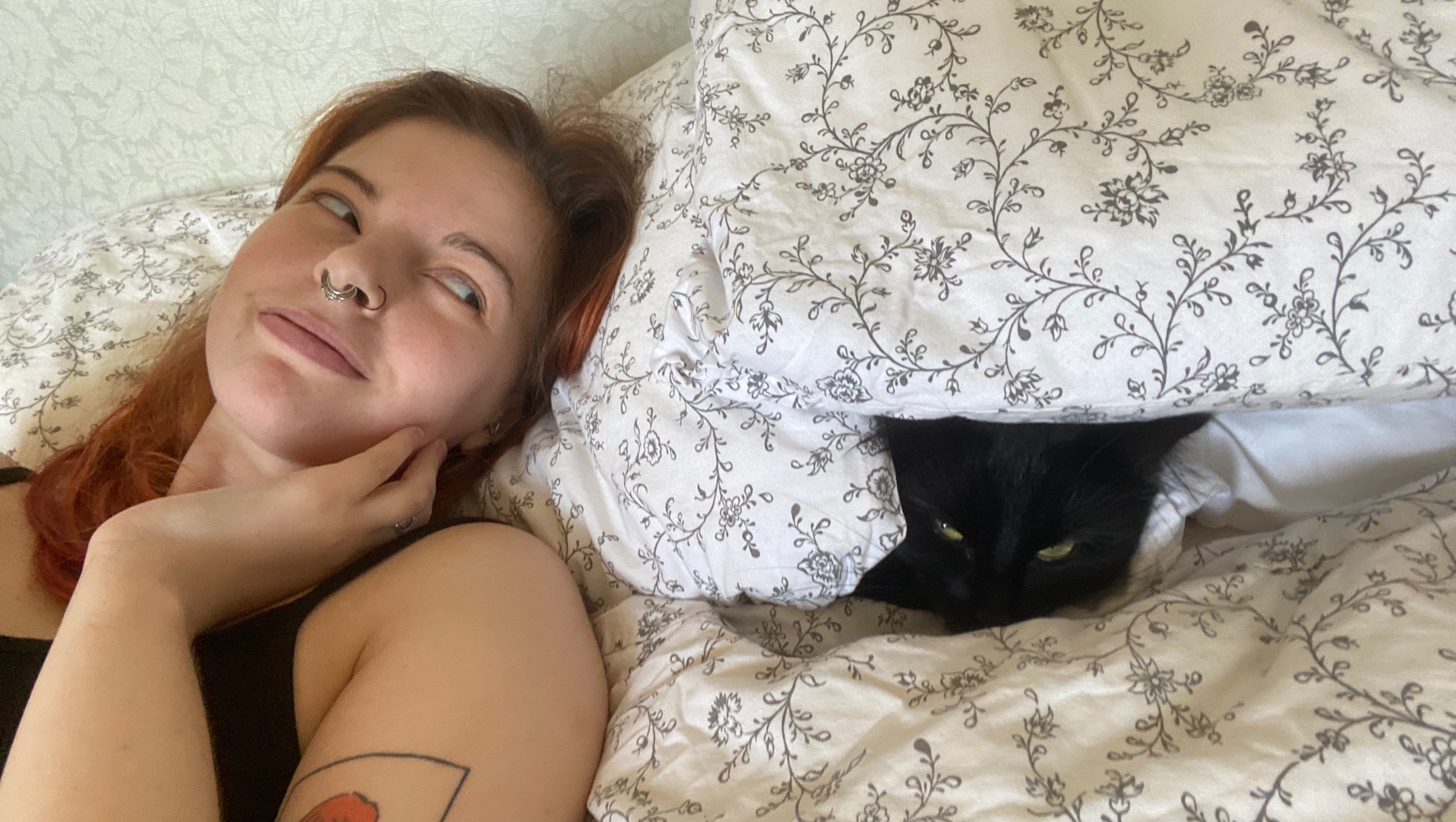 Fundraiser by Ruby Jones : Help Ru Receive Life Changing Surgery