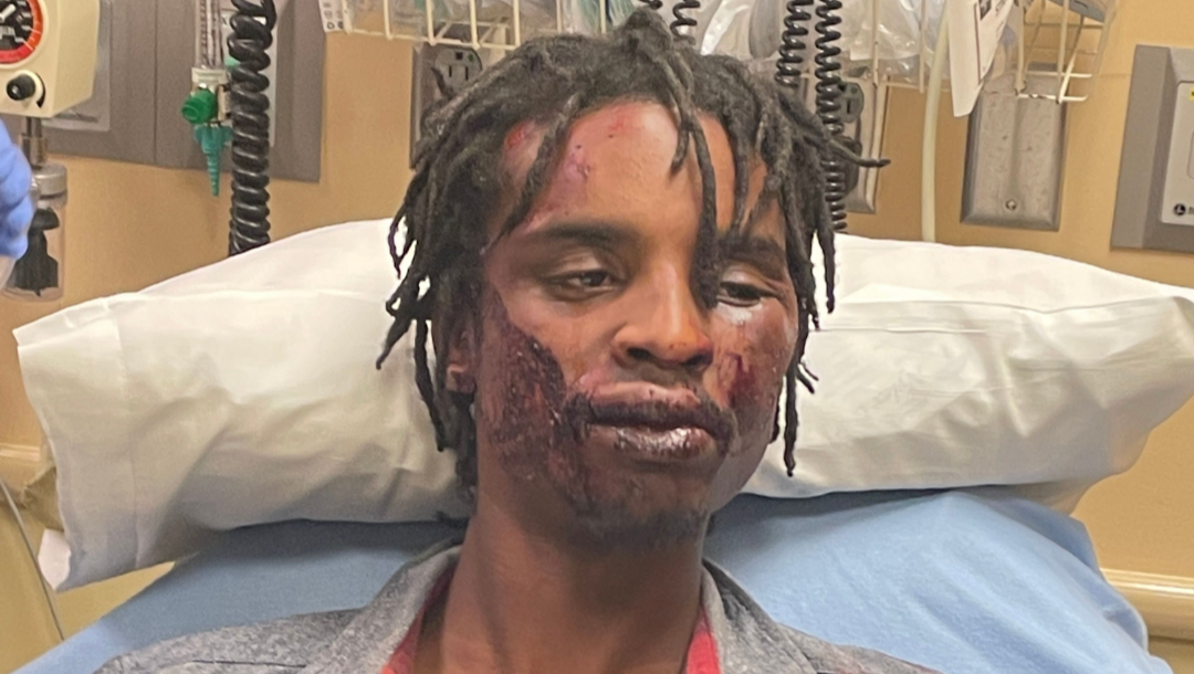 Police Brutality in Colorado Springs photo