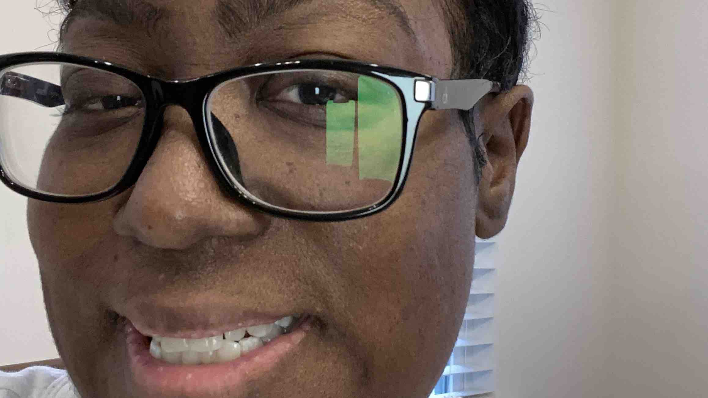 My kidney journey: living on dialysis photo