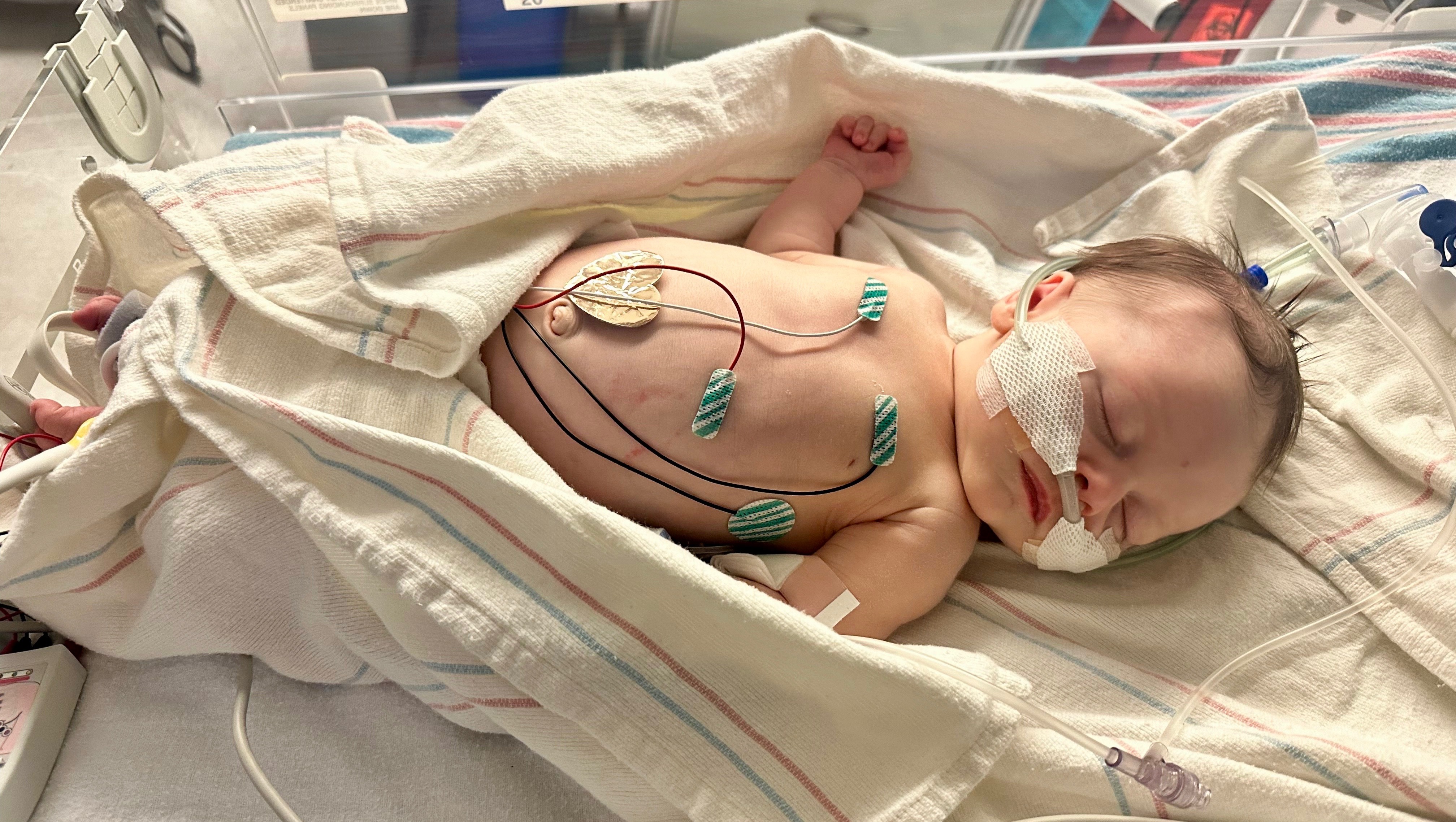 Baby Lenny's Hospital Bill photo