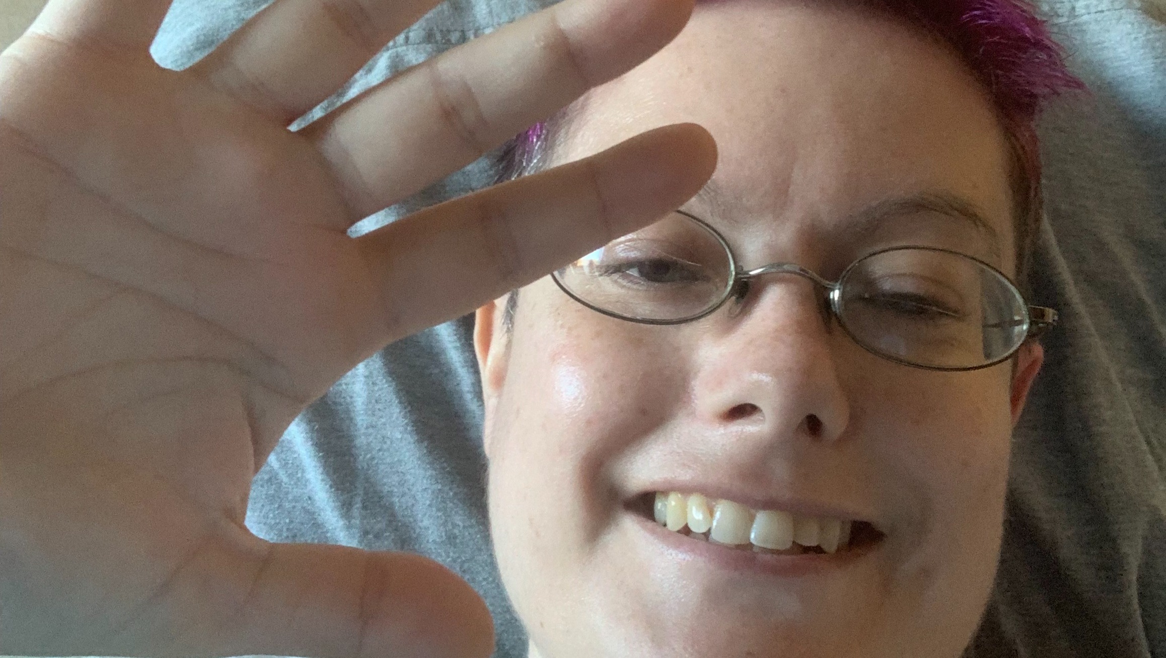 Help Kat Norris - Liver Tumor Medical Expenses photo