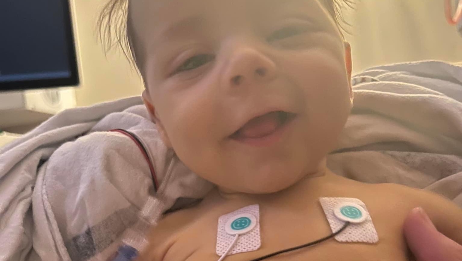 Xander’s battle against biliary atresia photo