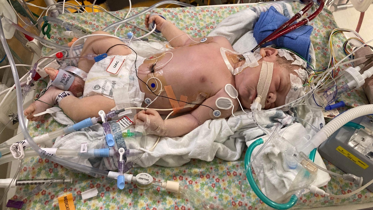 Fundraiser by Audrey Burrell : Baby Adley's Medical Expenses