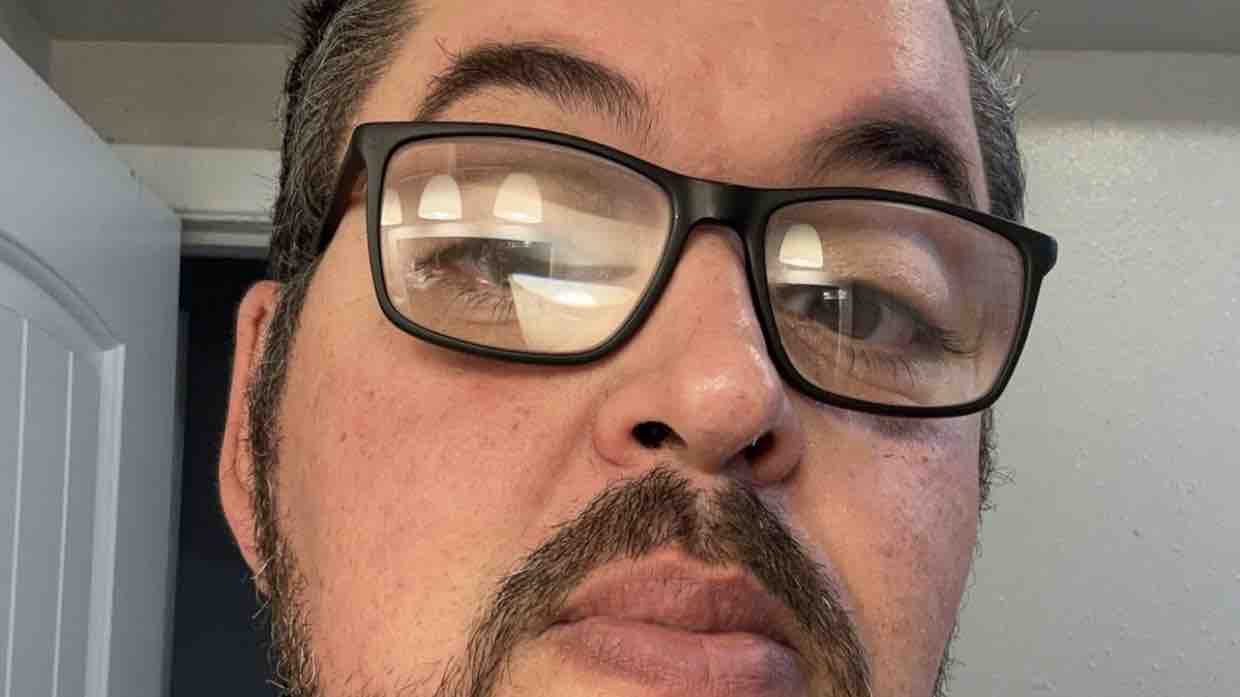 I suffer from SPS and multiple Liver cancer tumors photo