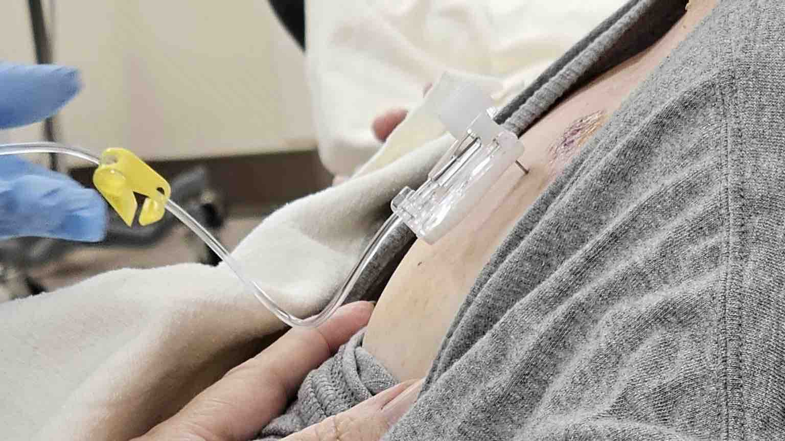 Sudden Stage 3 Cancer Diagnosis photo