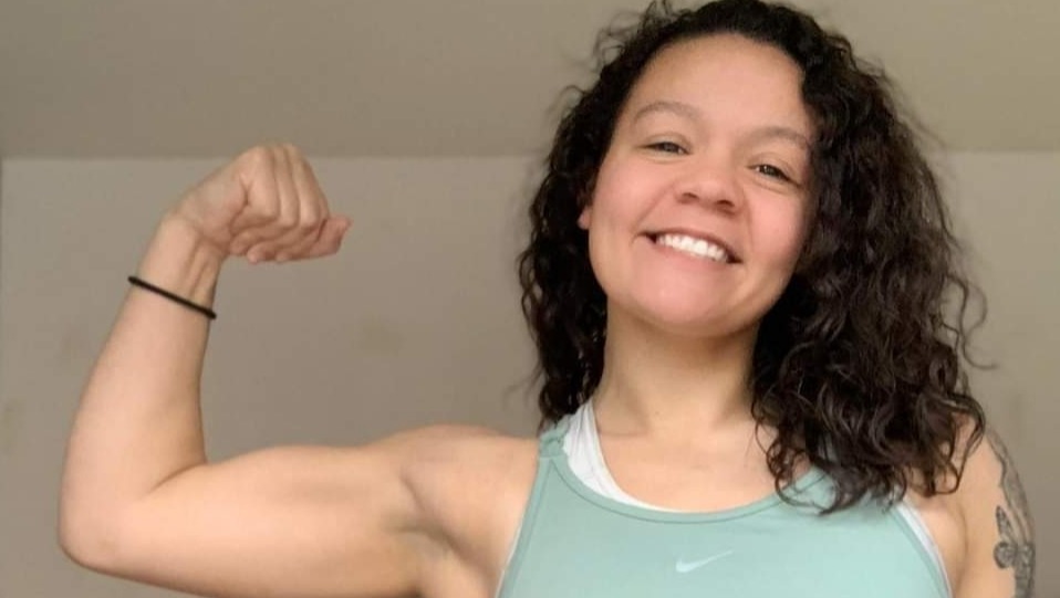 Jamie's shoulder surgery photo