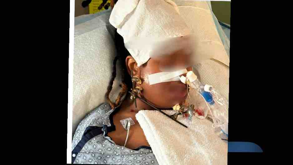 Support Teen Girl Who Was Shot In The Face photo