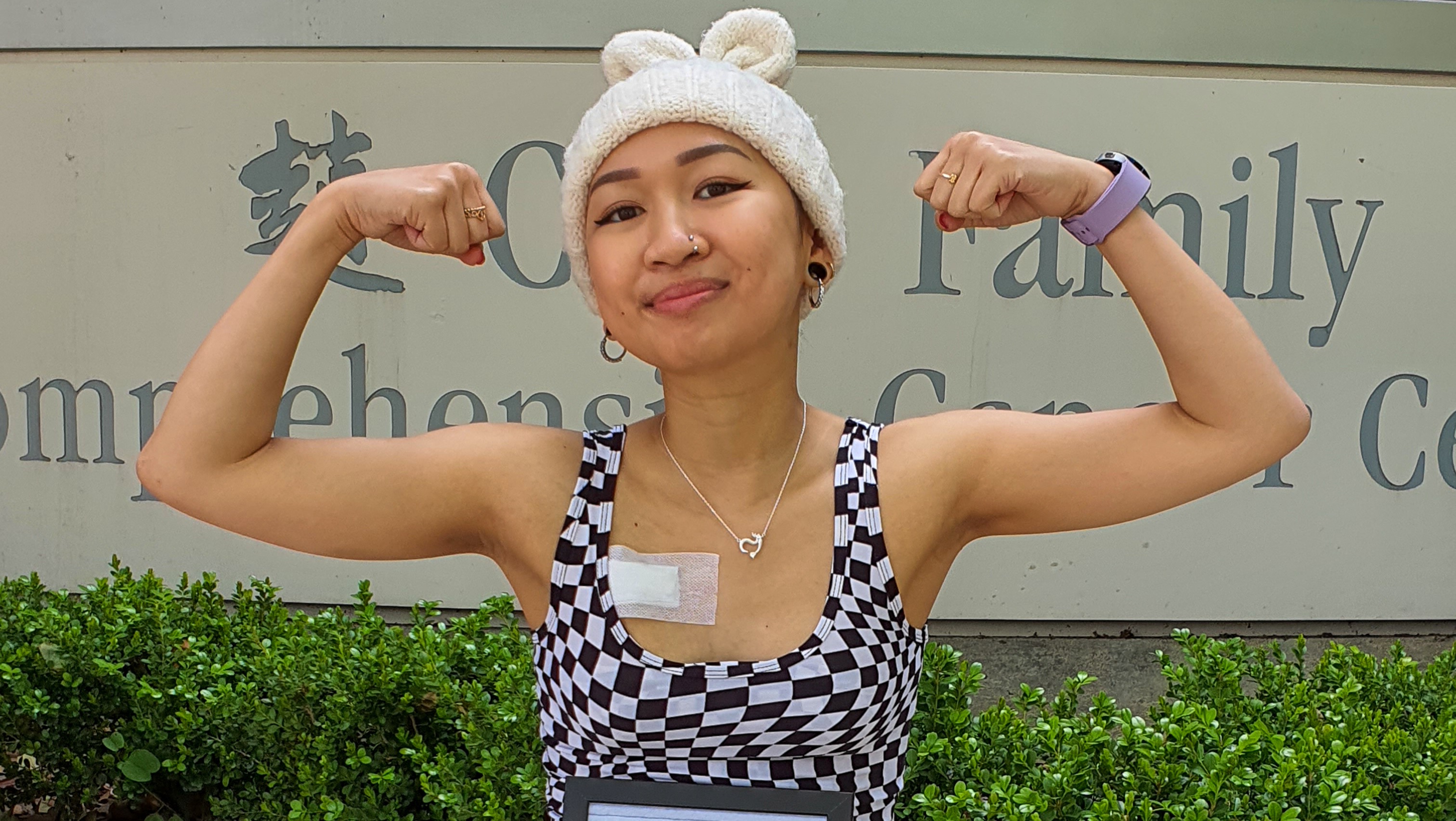 Swollen Toes – My Fight Against Bone Tumors And My Recovery - sxcx4kf