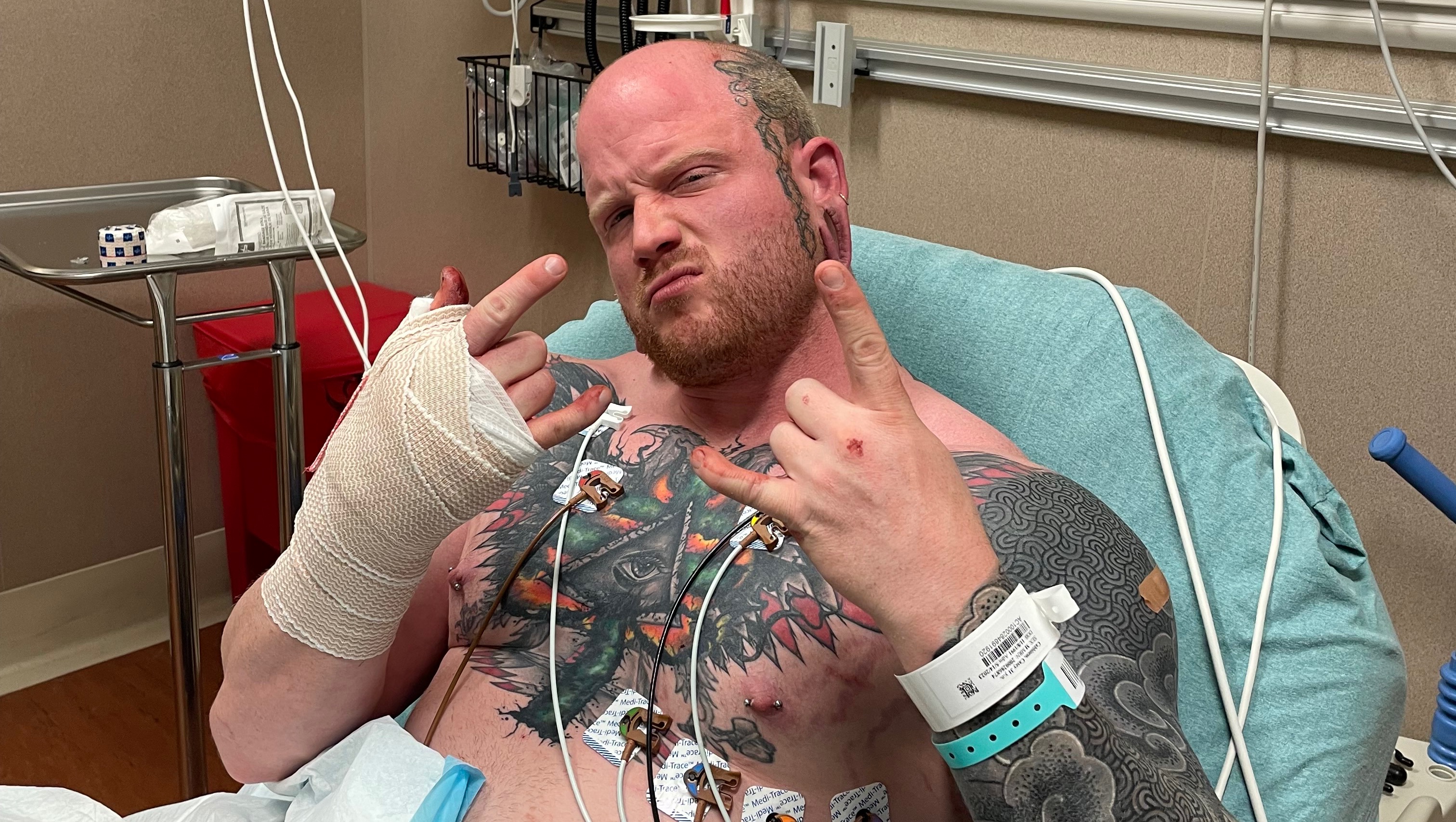 Fundraiser for Casey Cabbiness by Sarah Zeh : Help Casey Reattach His Thumb