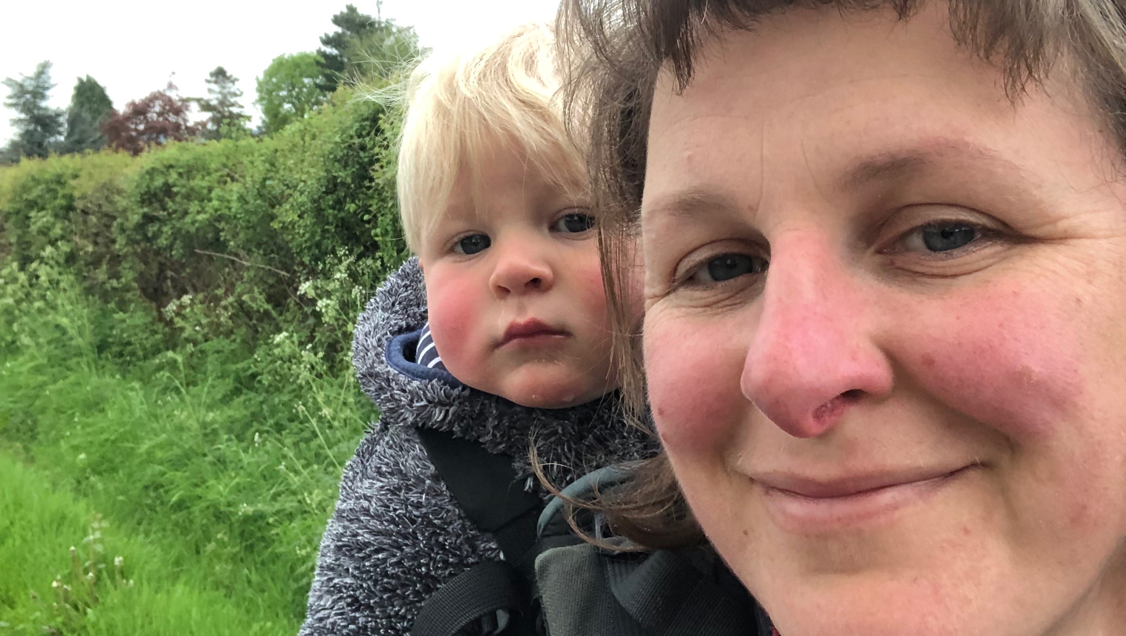 Fundraiser by Rebecca Nemeth Newcastle RVI plastics and hand unit