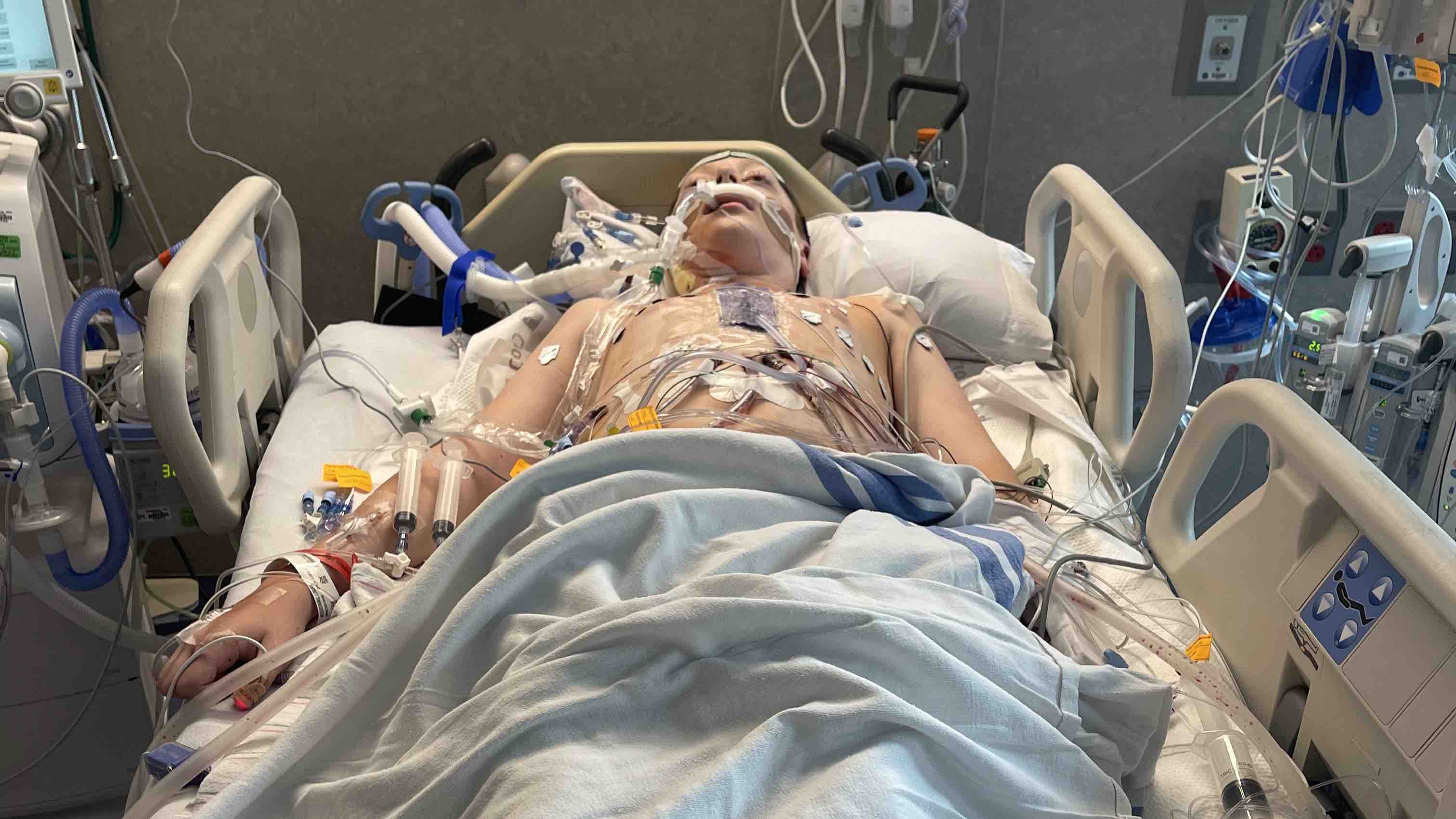 Logan’s Heart Transplant photo