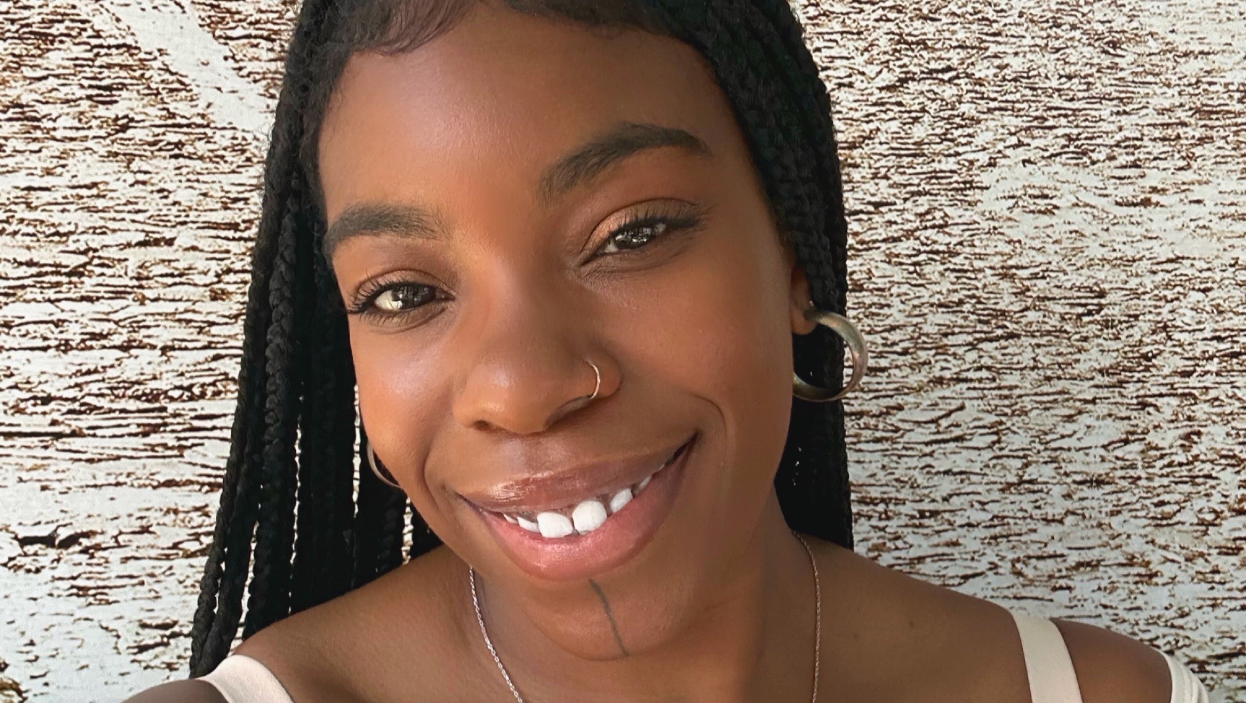 Support Anna in Car Accident Recovery photo