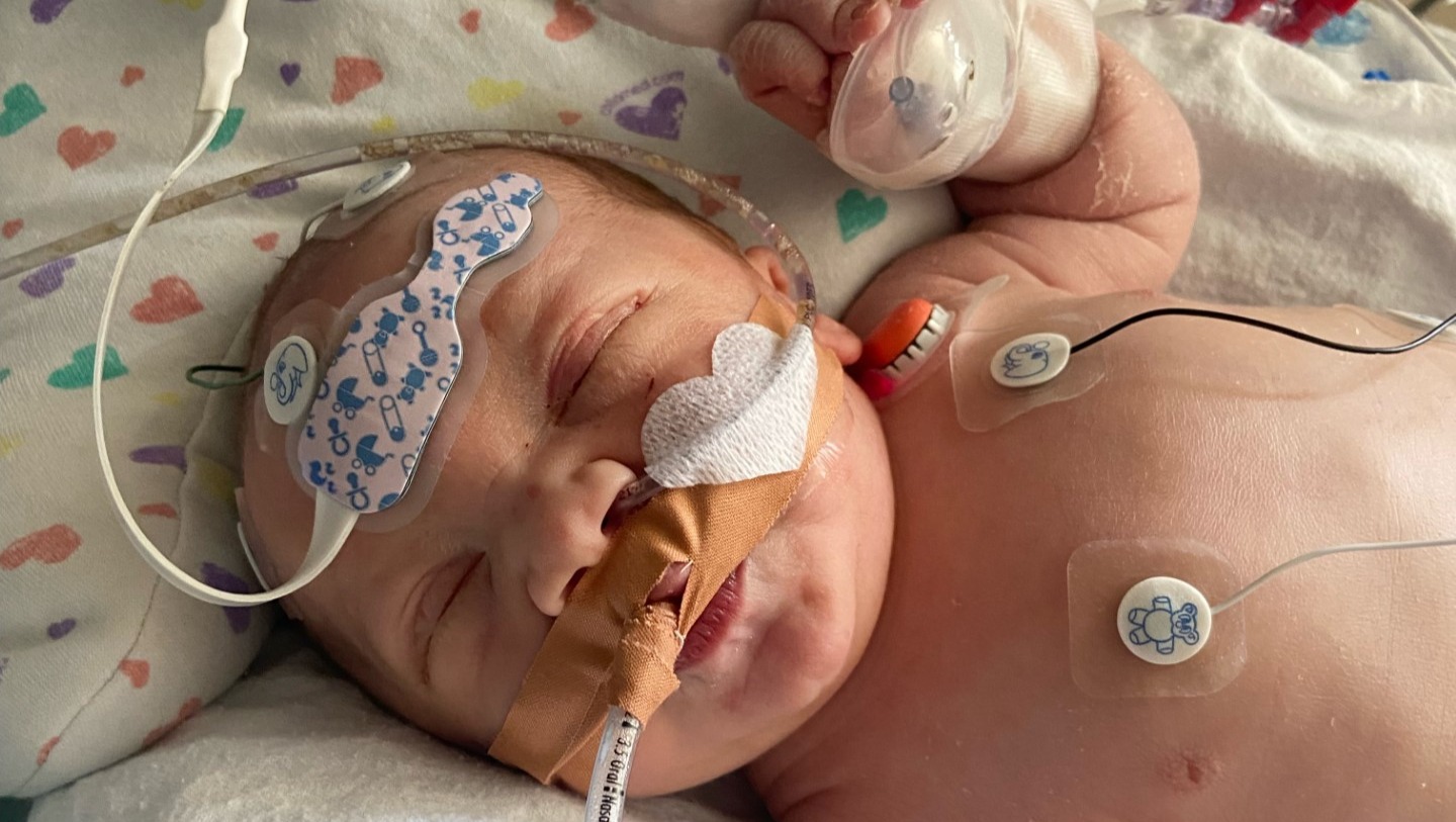 Help for baby Leo and his family photo