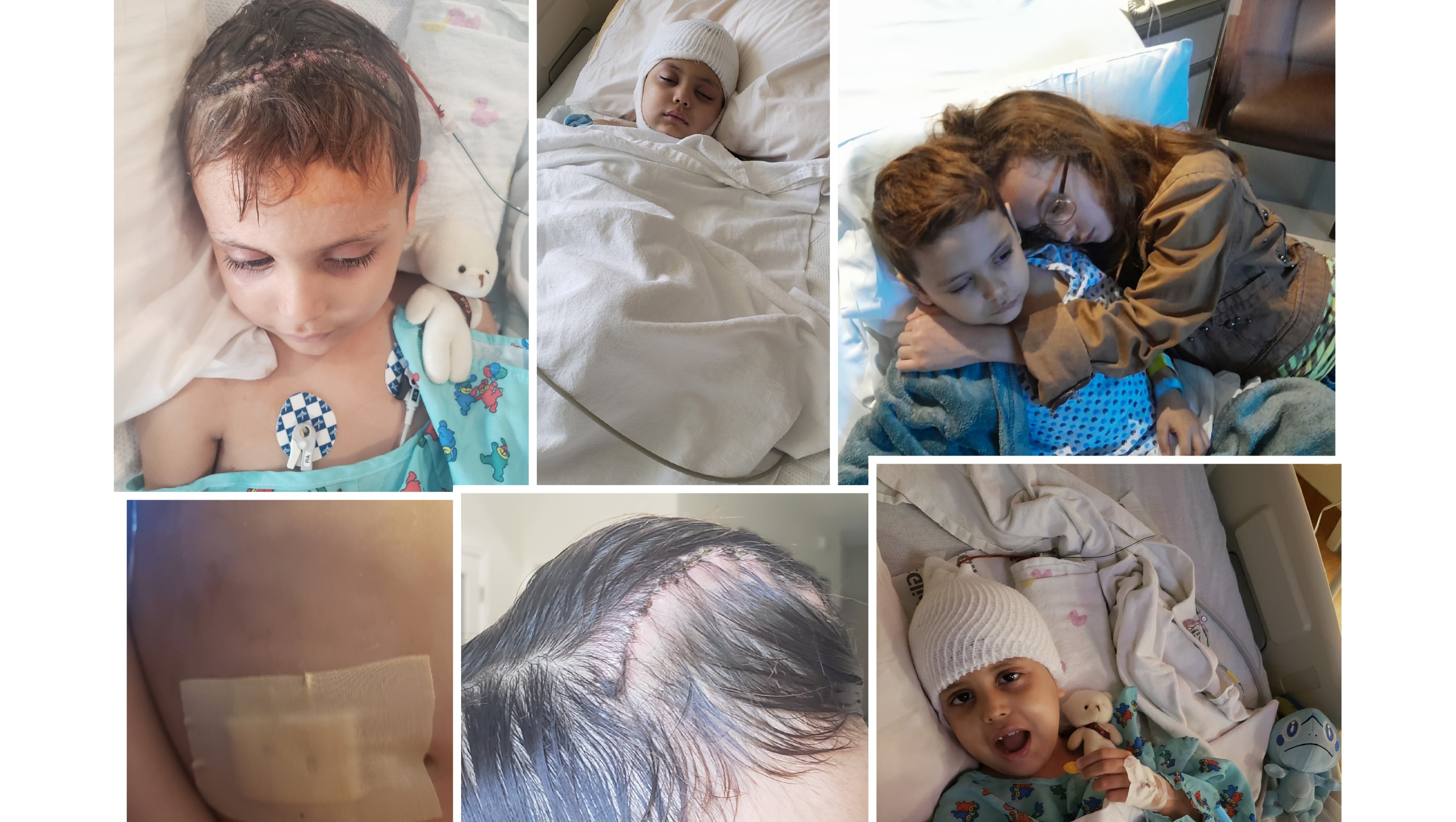 Obdulia Sanchez Sister Head Injury - 19ps9fw