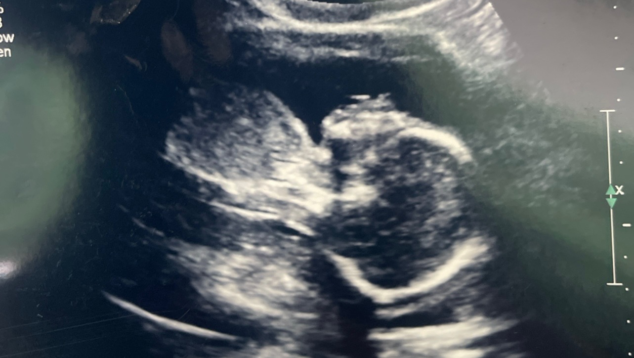 Samantha and Baby Leighton  photo