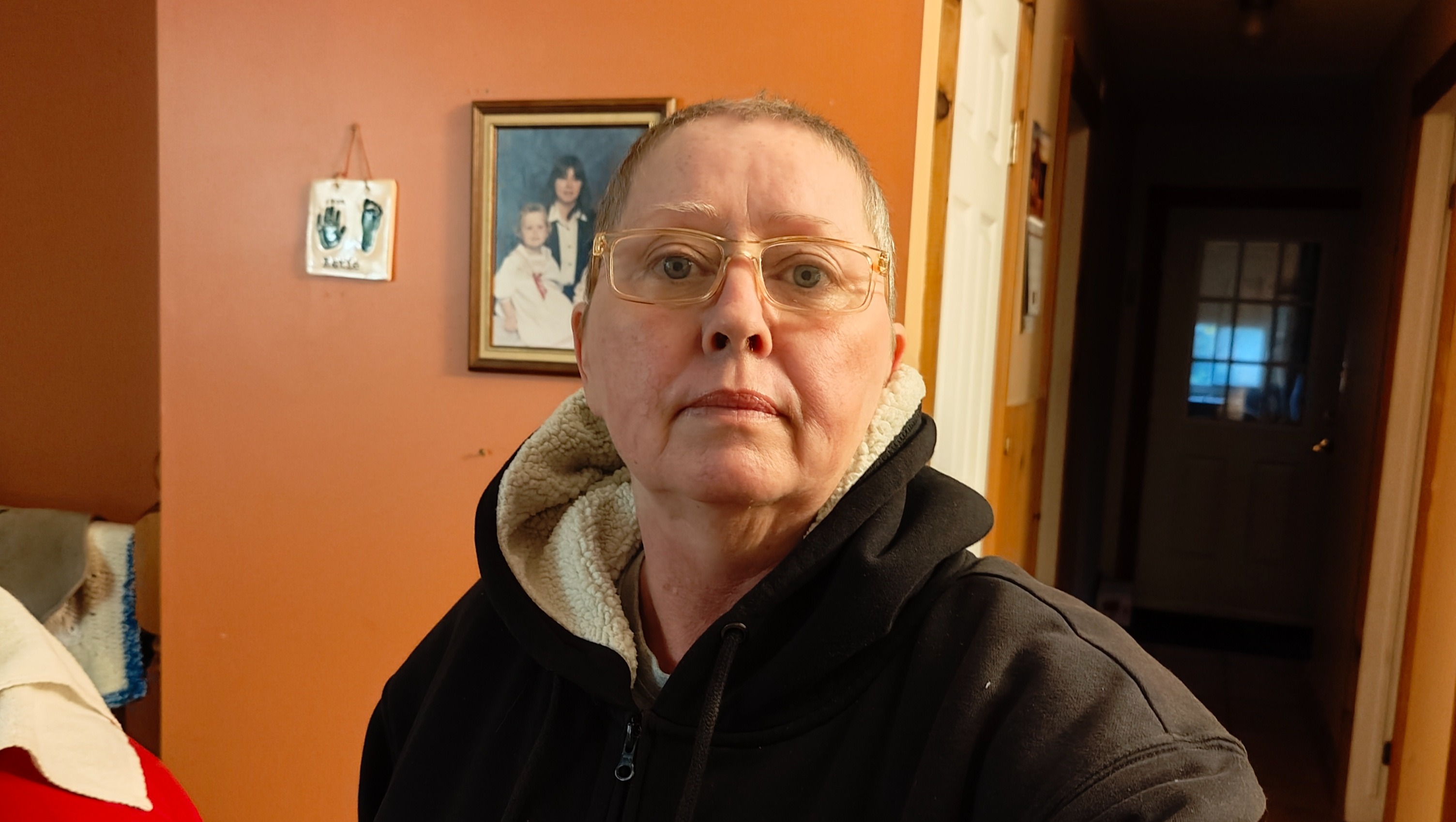 Unseen Photos: Glenda Lewis'S Cancer Journey - of0uffs