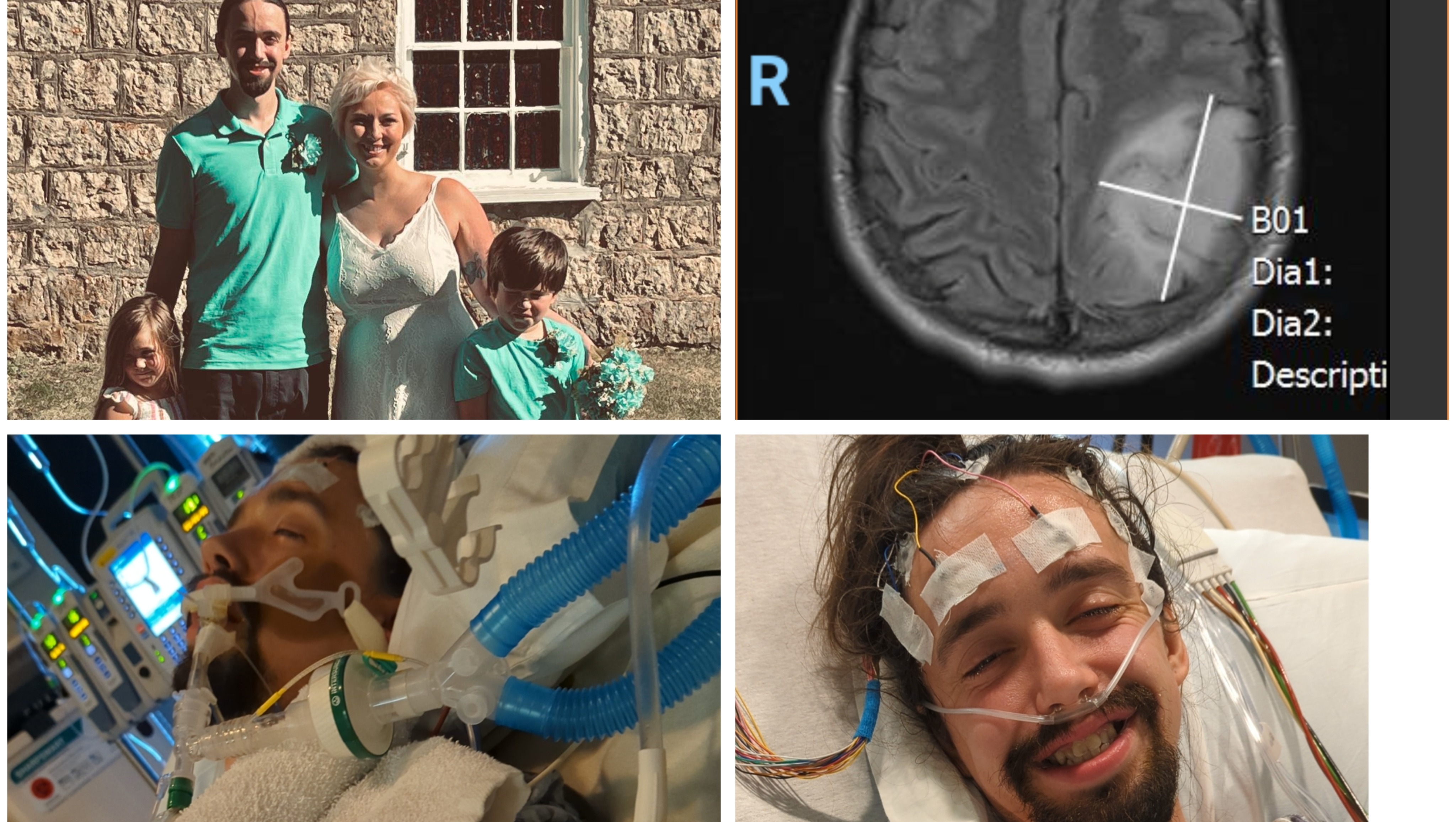 Cnn Anchor'S Health Crisis: The Brain Tumor Battle - tlnlsdm