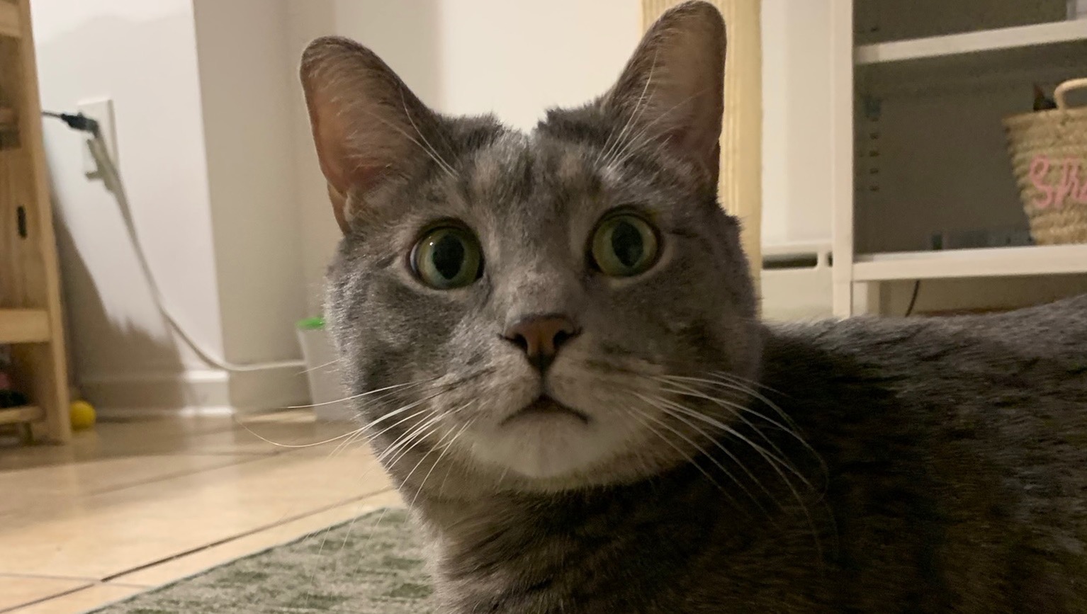 Fundraiser for Samuel Jin by Sharon Park : Archer’s UO Procedure