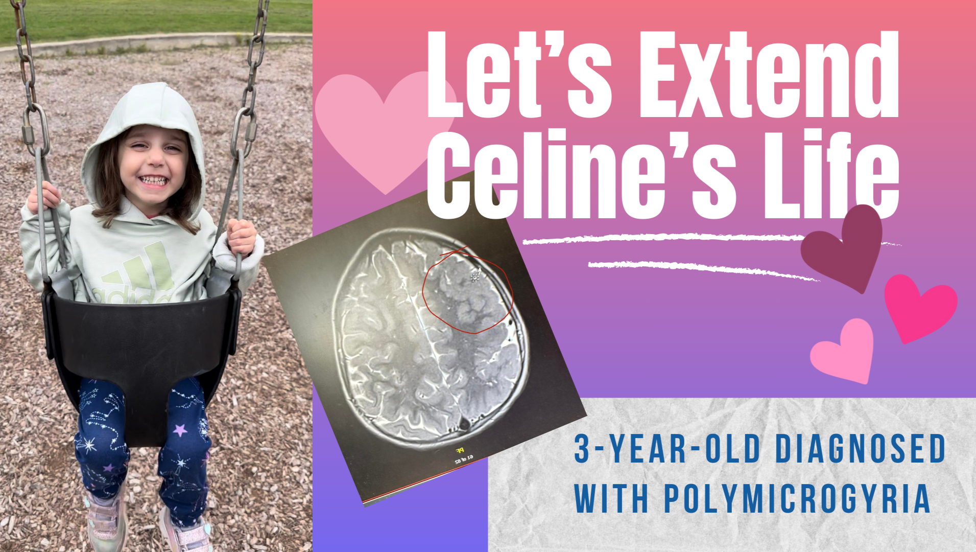 Let's  Extend Celine's Life photo