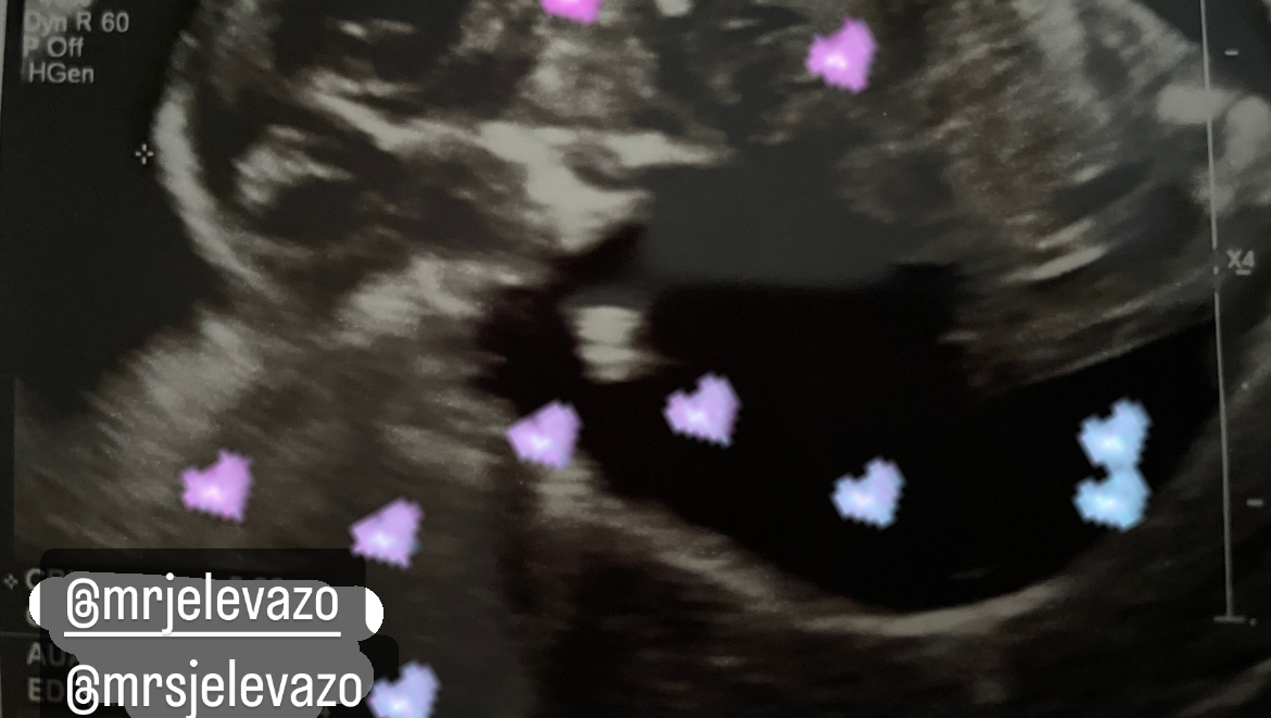 Donate to My Wife&#039;s High Risk Pregnancy, organized by Judel Dee Elevazo