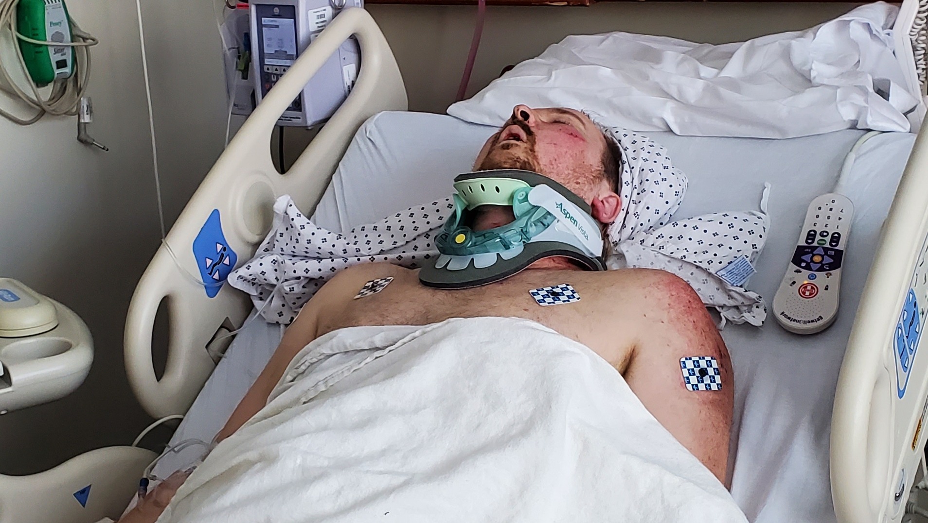 My nephew Zachary was in a motorcycle accident photo