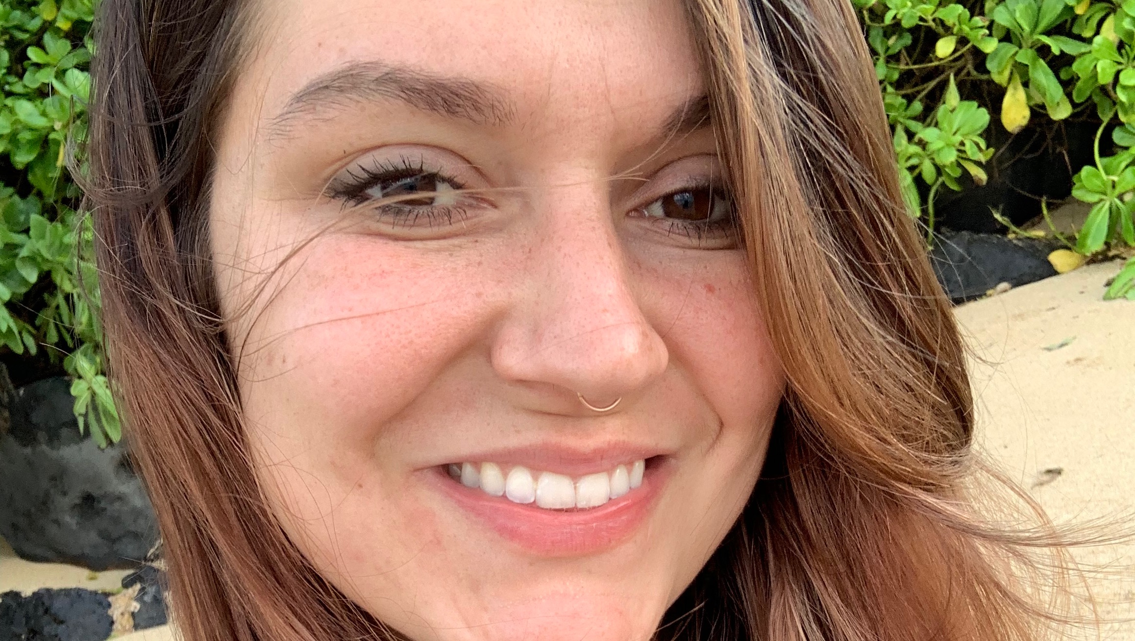 Medical expenses and cost of living photo