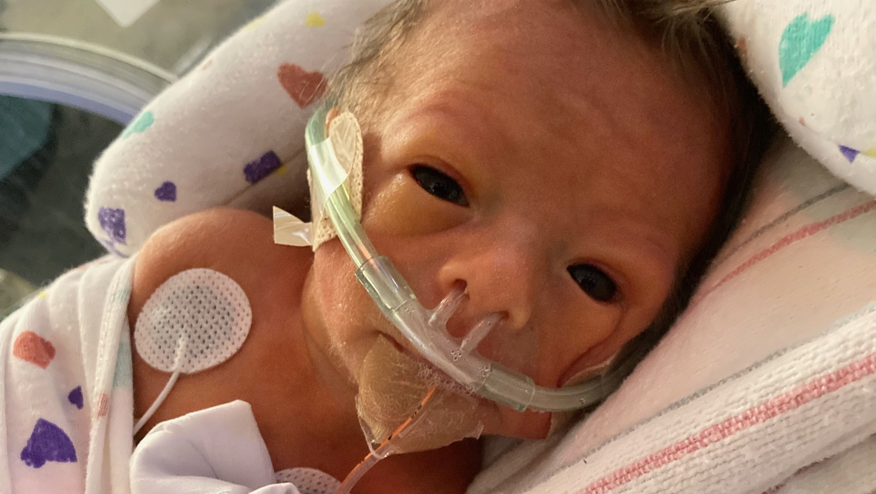 Support Baby Theo- Heart Surgery and NICU Fund photo