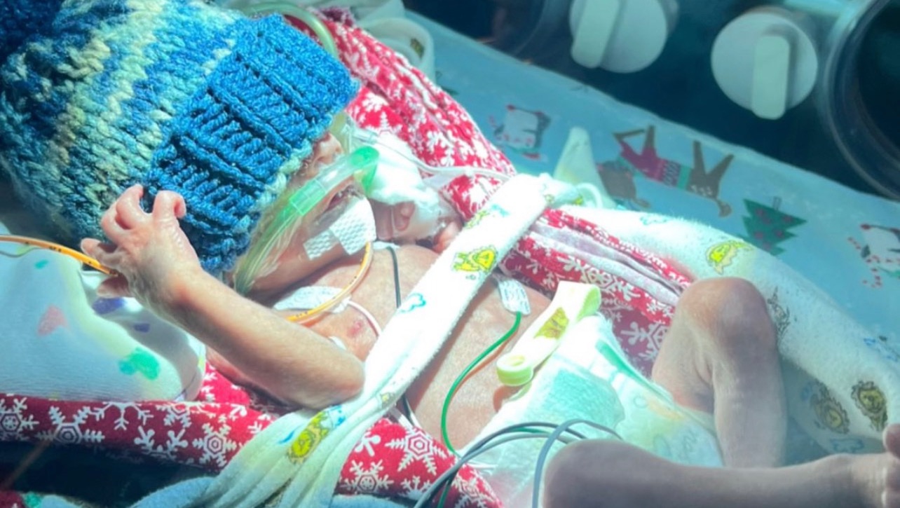 Baby Secore’s Emergency Birth photo