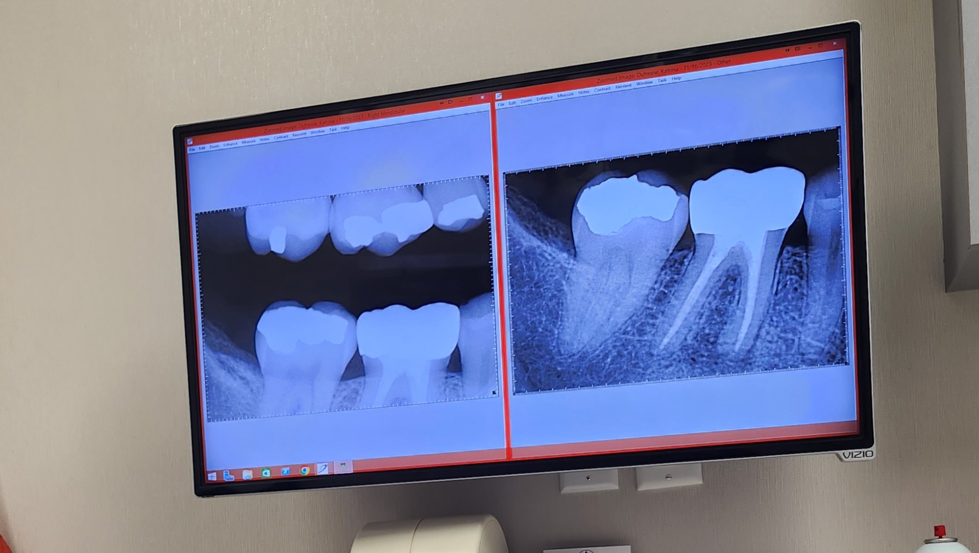 Fundraiser by Katrina Dufresne Help Cover Emergency Dental Bills