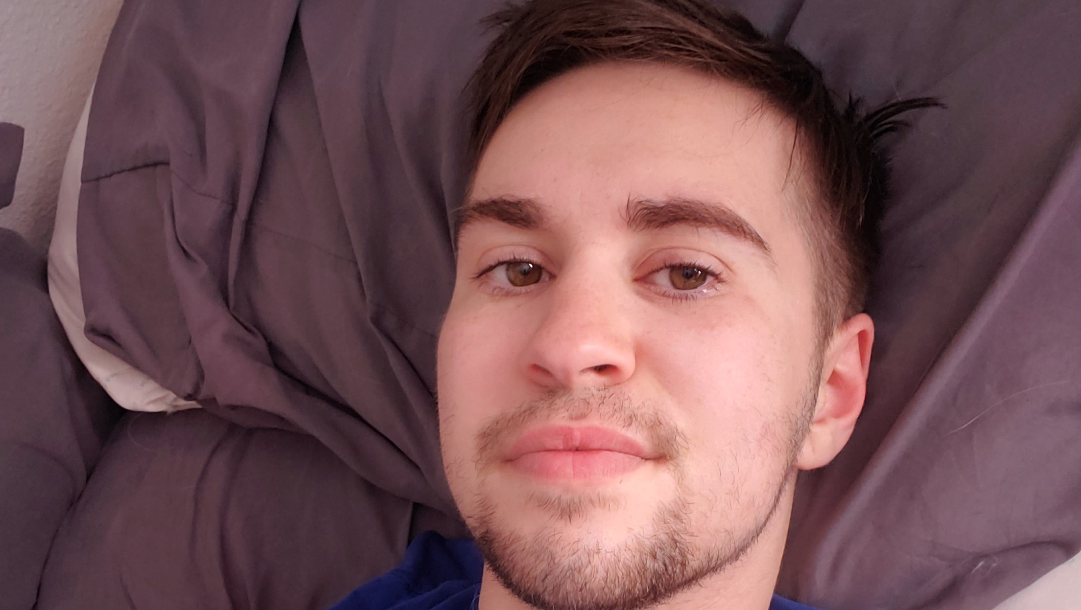 Fundraiser by Chase Endries Help Chase cover electrolysis & surgery costs