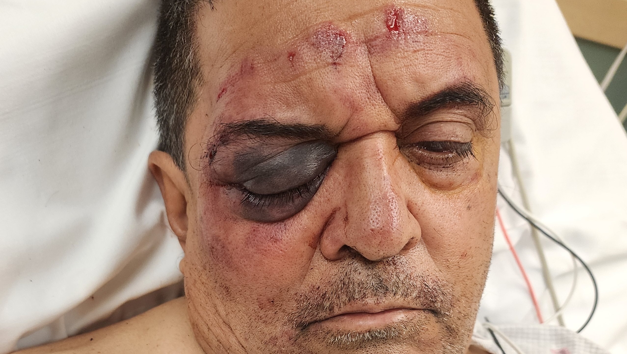 Please help us save Bobby's Eye photo