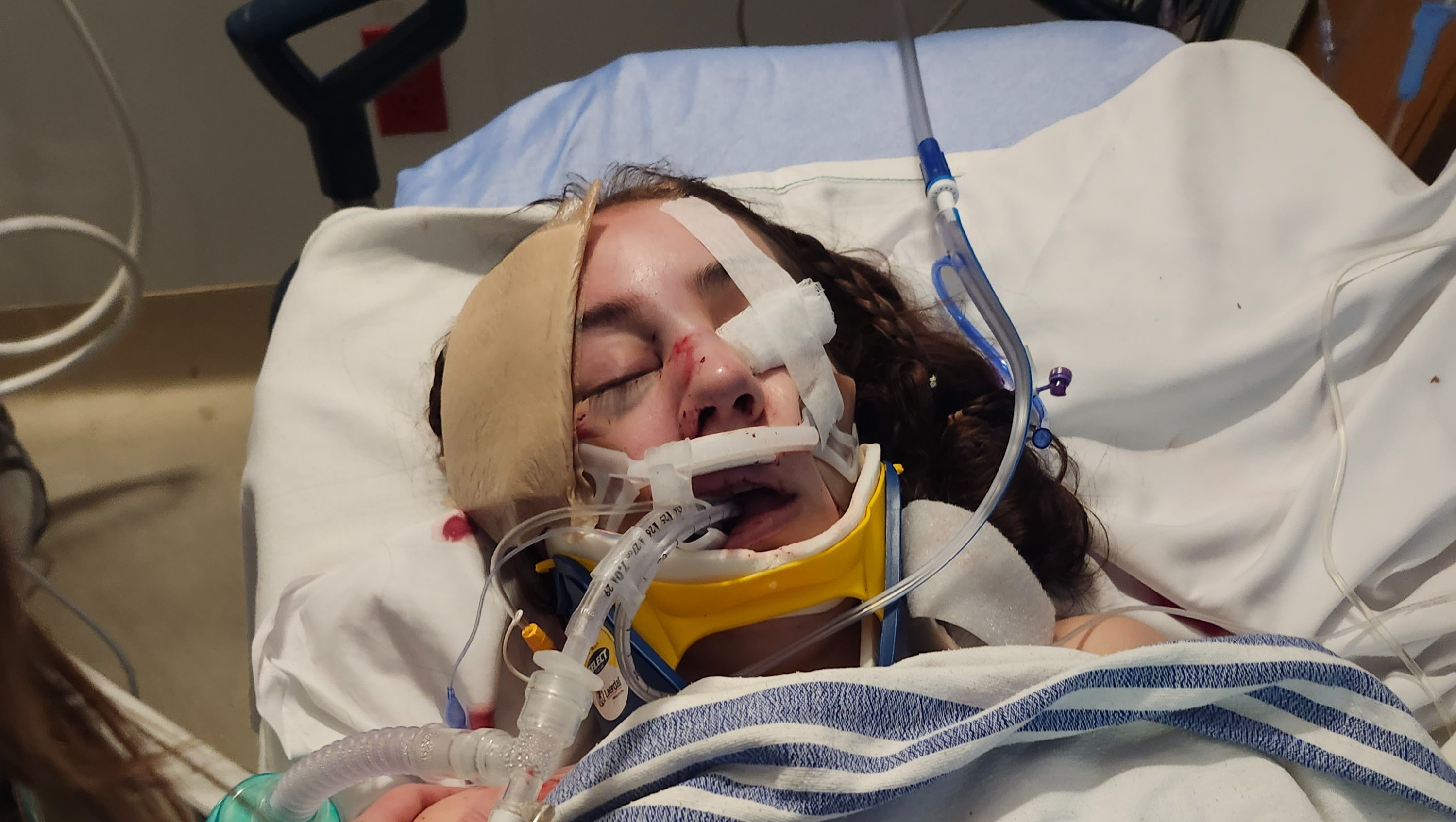 Hailey Sigmond'S Road To Recovery After Viral Scandal - f5aekqf