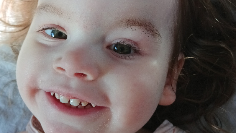 Terminal 2 yr old needs your help and support photo