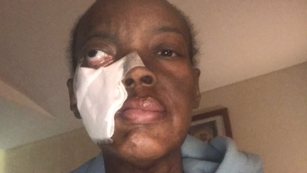 Immunotherapy Sponsorship For Cancer Recovery photo