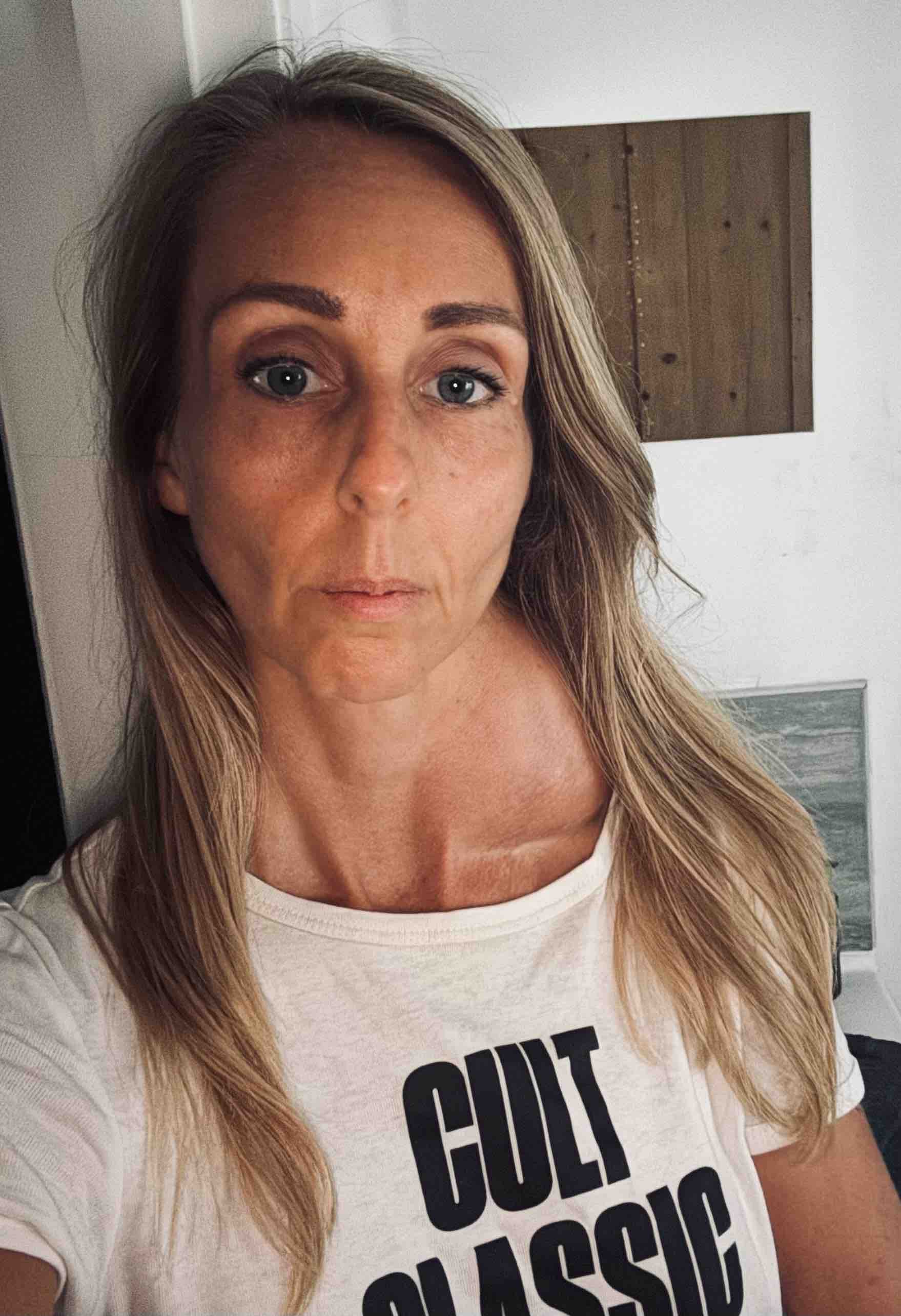 Help Laura Heal: CRPS Recovery & Tumour Support campaign photo, 2 of 6