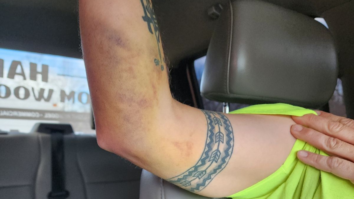 surgery for my cousin and best friend photo