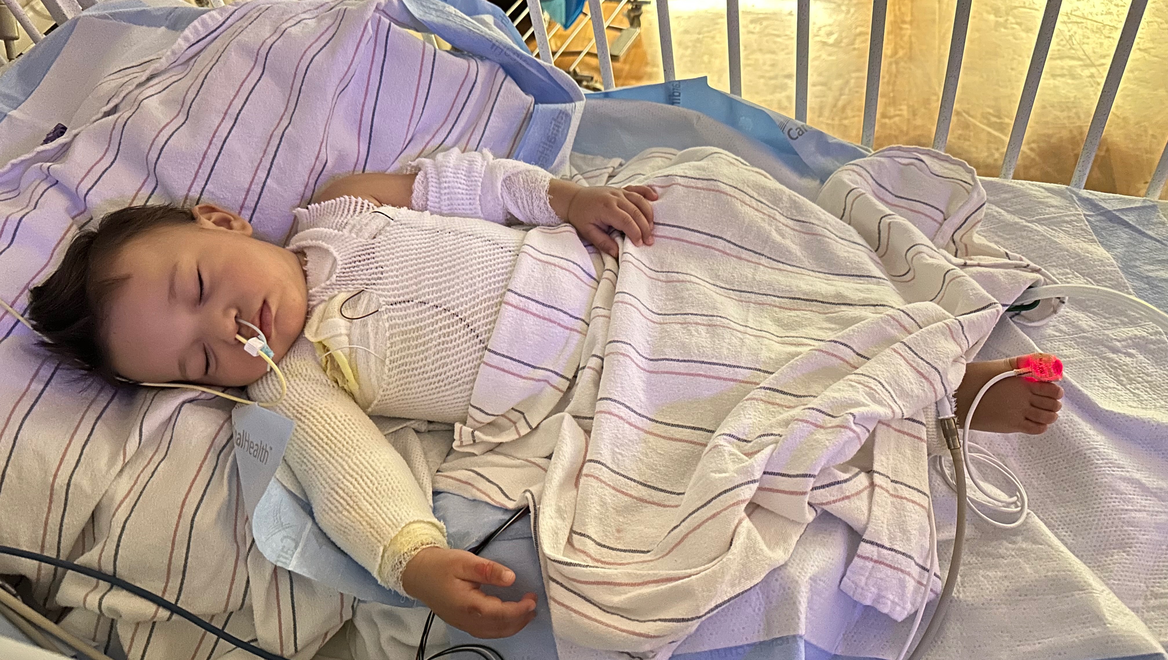 Burn Survivor, Please help the family of Giancarlo photo