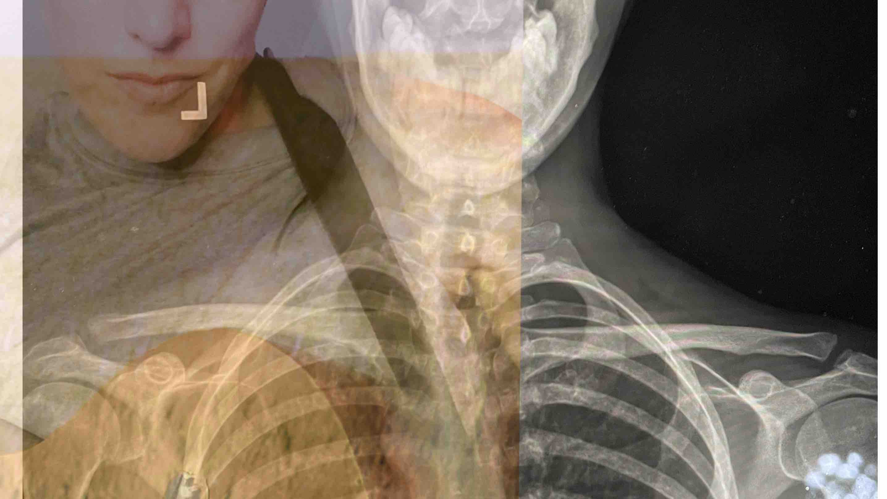 Fundraiser by Kelly Zullo Send me some karma in this medical issue circus