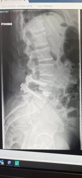 Life-Saving Surgery Maxillofacial & Neurological campaign photo, 6 of 8