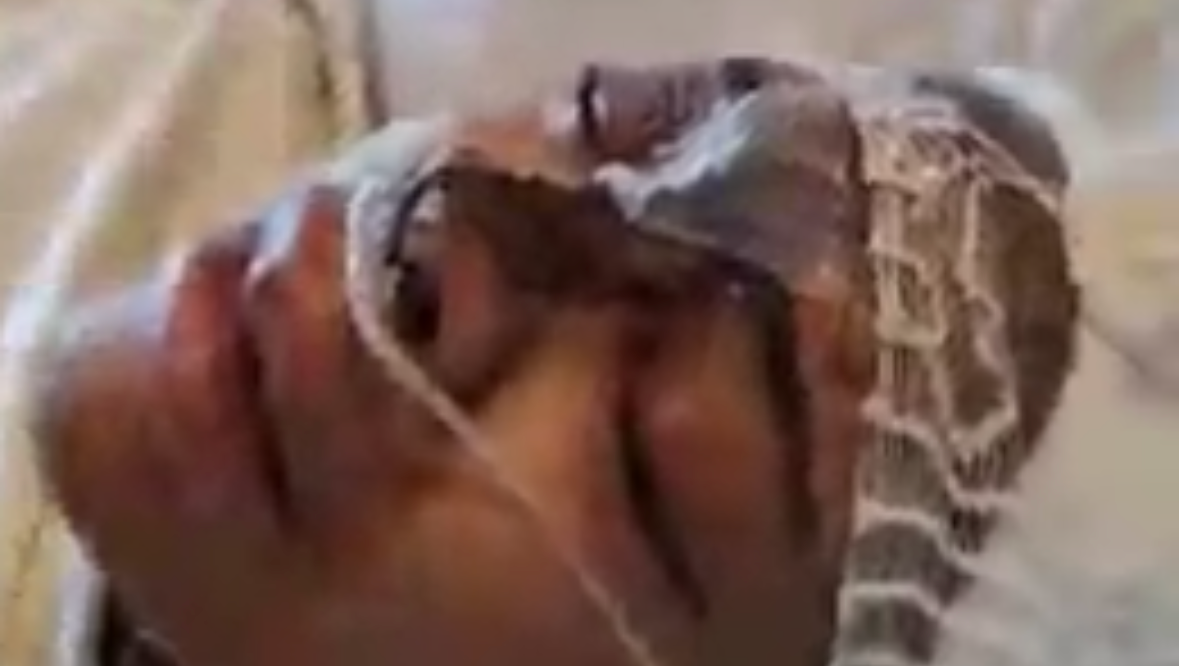 Grenique road to recovery (surgery) photo