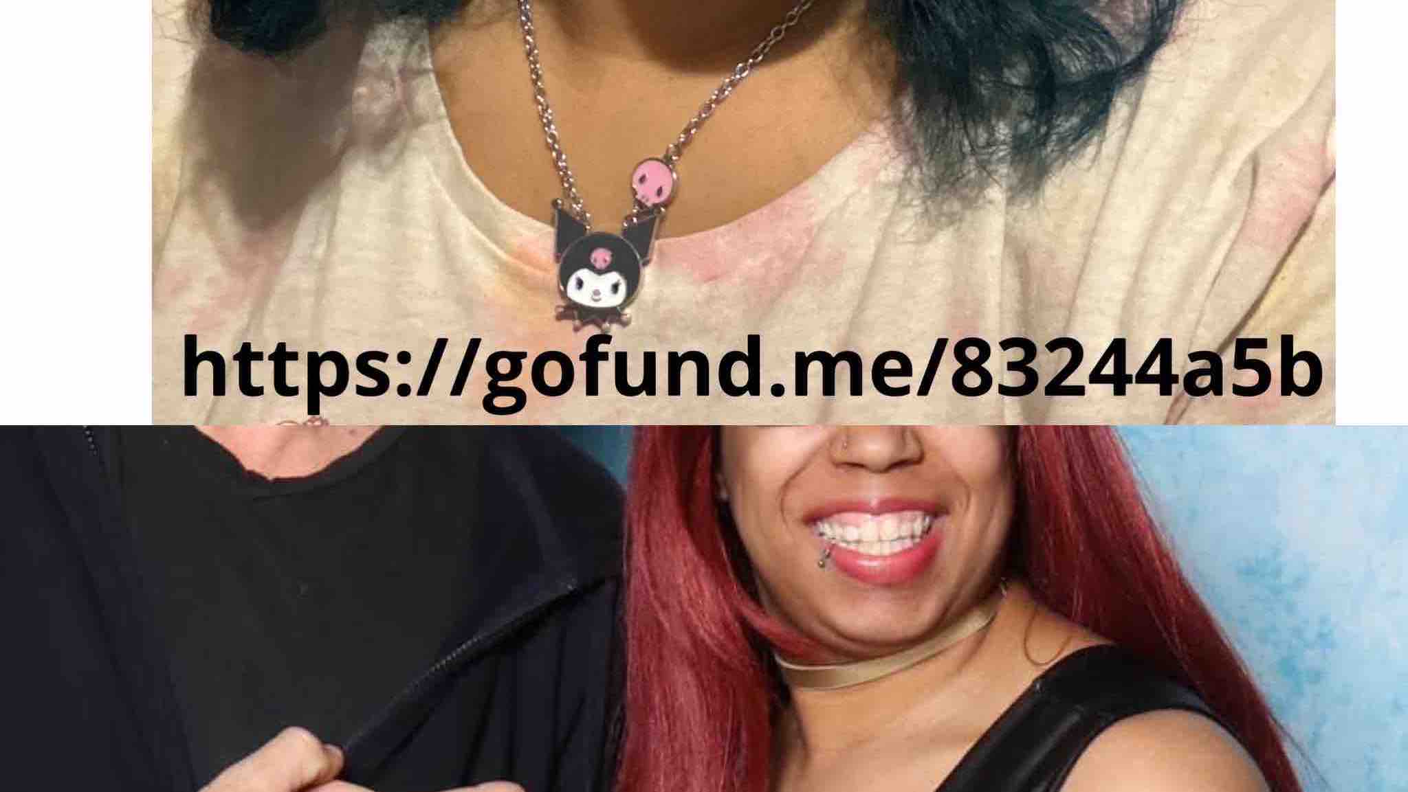 Help me smile again with dental work photo
