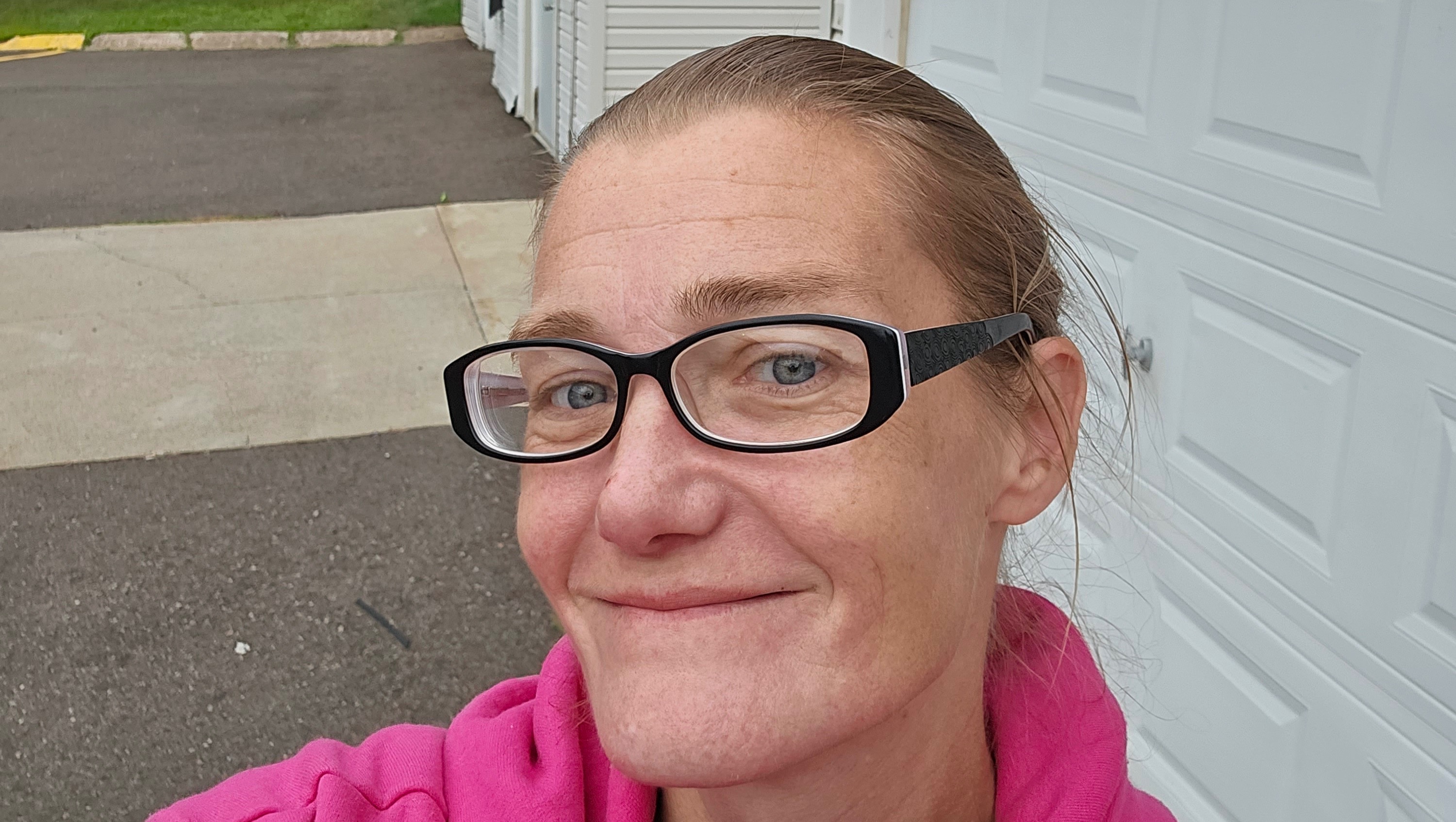 Jess King'S Health Journey: Why She Chose Boob Reduction Surgery - m829blc