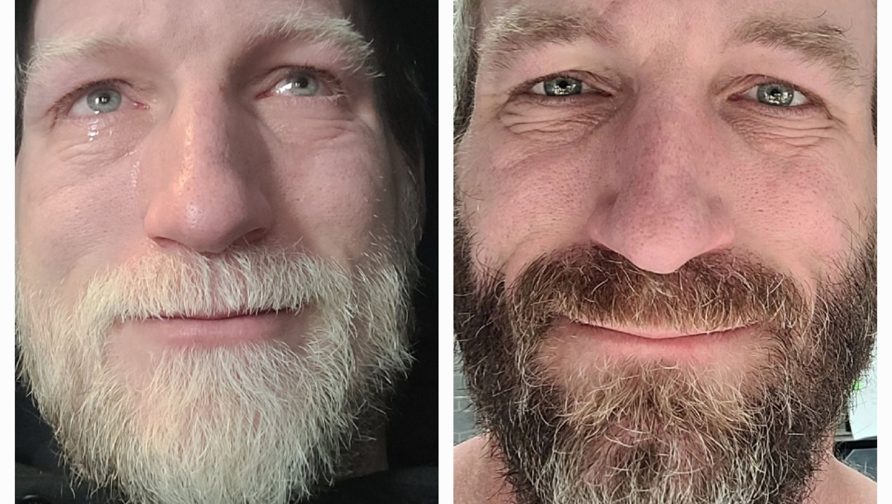 Support Anthony's Fight Against Gist Cancer (updated) photo