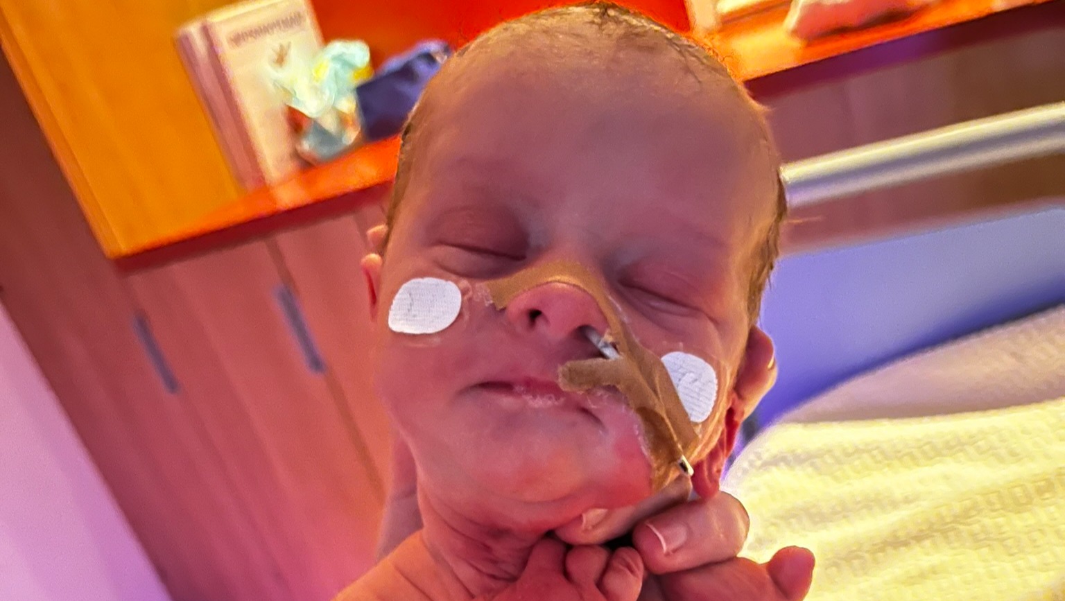 Bebé Zoë e o erro medico que lhe deixou paralisada photo