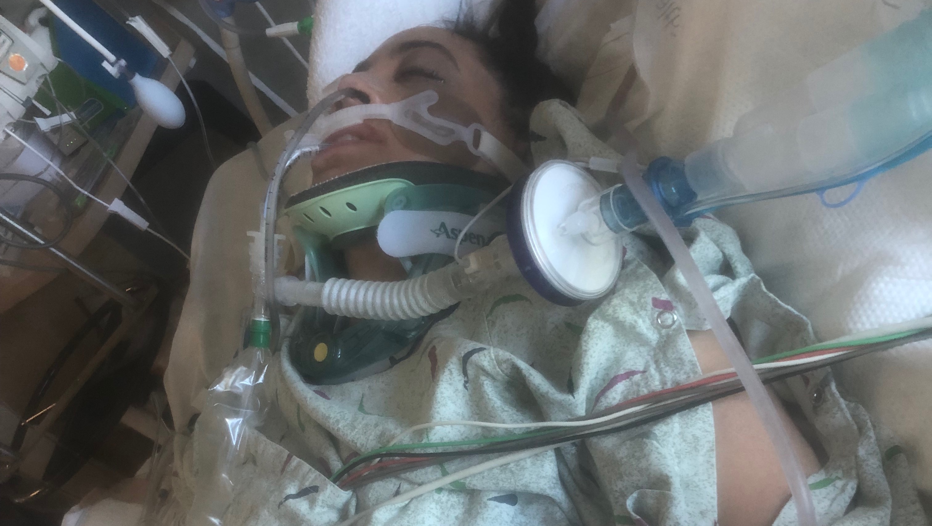 Eye Injury Sidelines Alicia Acuña: Full Recovery Possible? - vt6uvhc