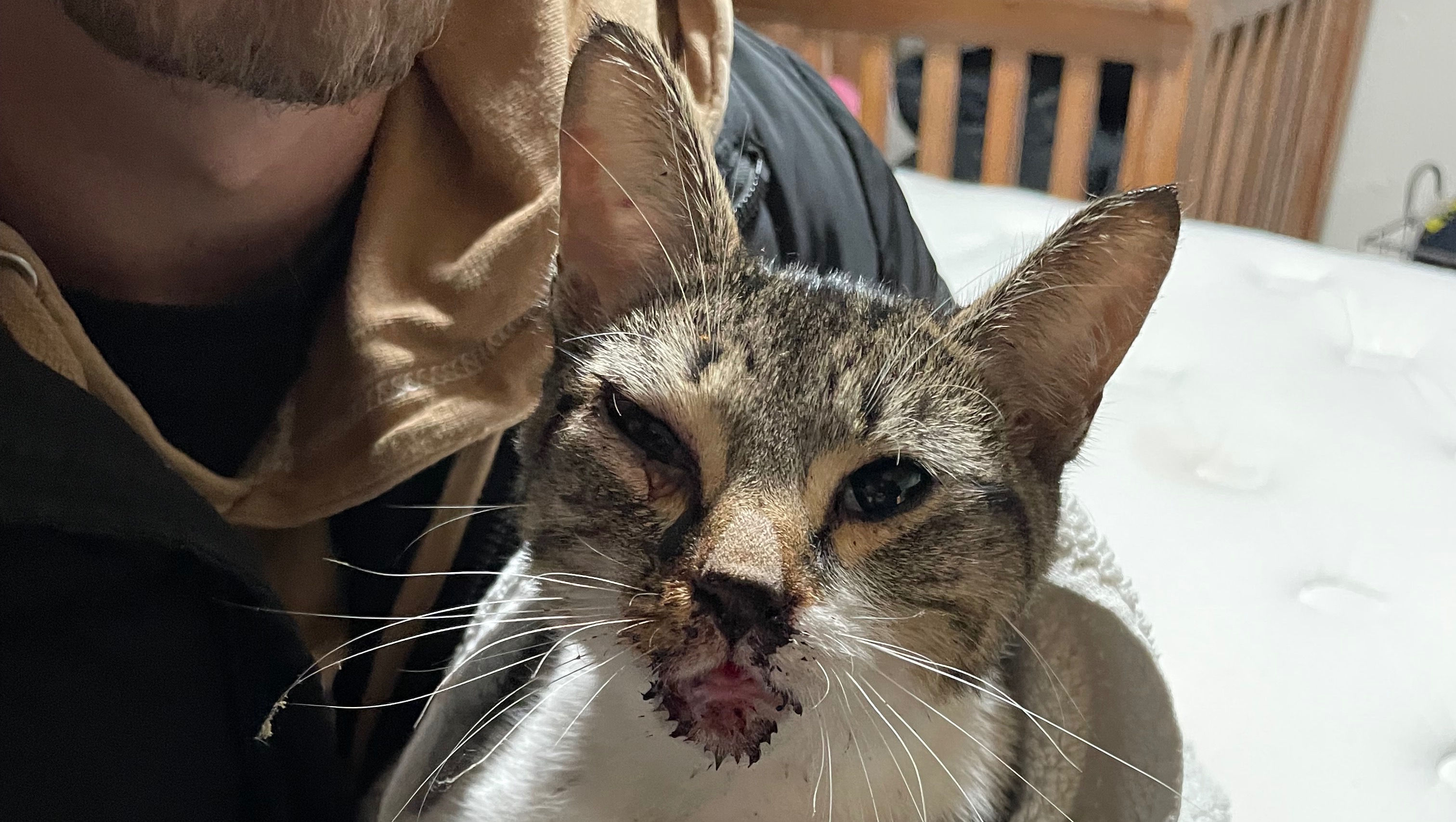 How Long Does It Take A Broken Jaw To Heal