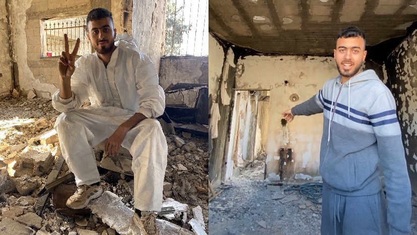 Photo Support Mazen’s Fight for Survival in Gaza