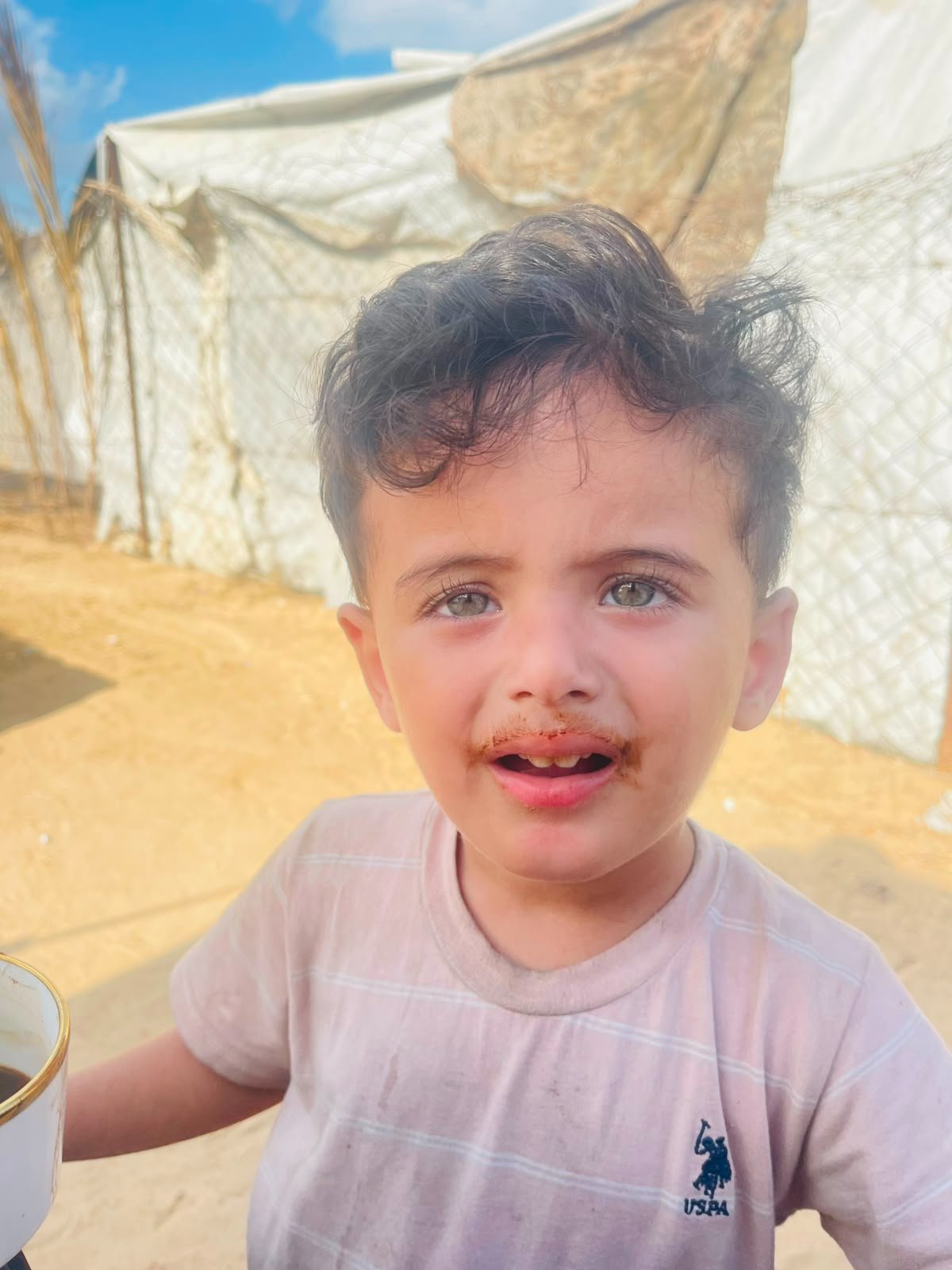 Help Nasser Get Treatment for Skin Disease and Start School campaign photo, 2 of 7