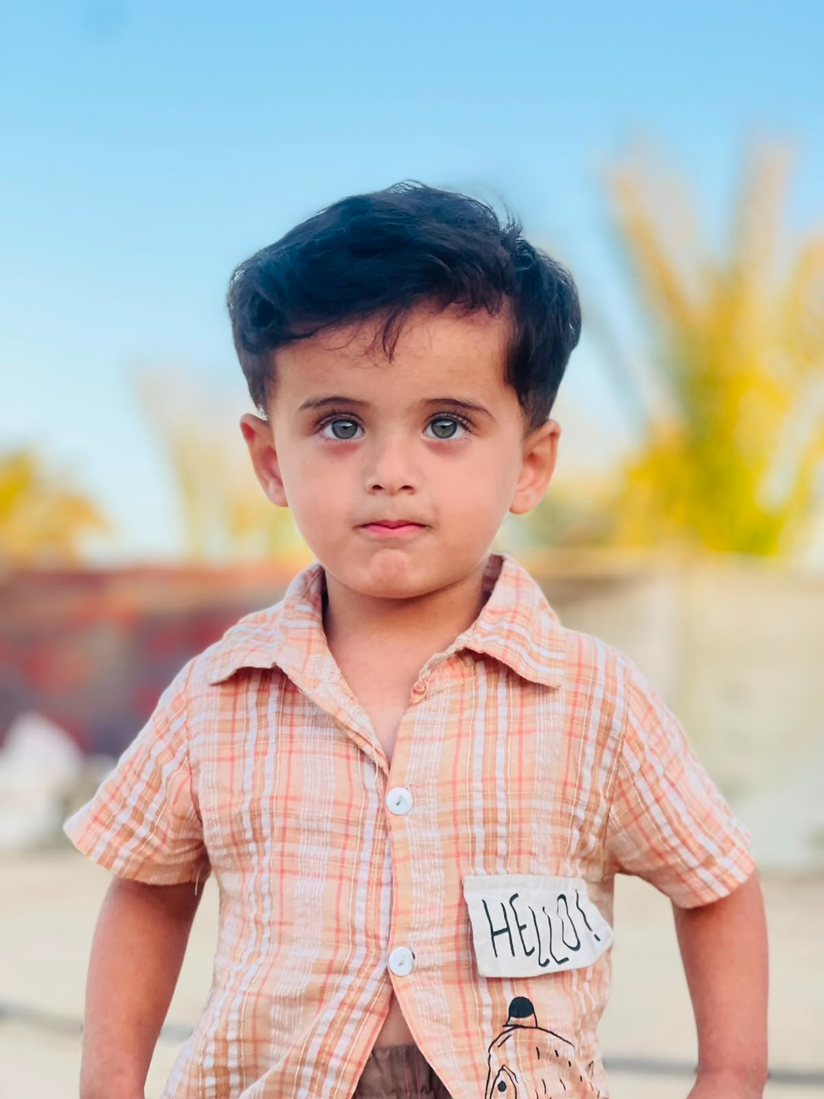 Help Nasser Get Treatment for Skin Disease and Start School campaign photo, 4 of 7